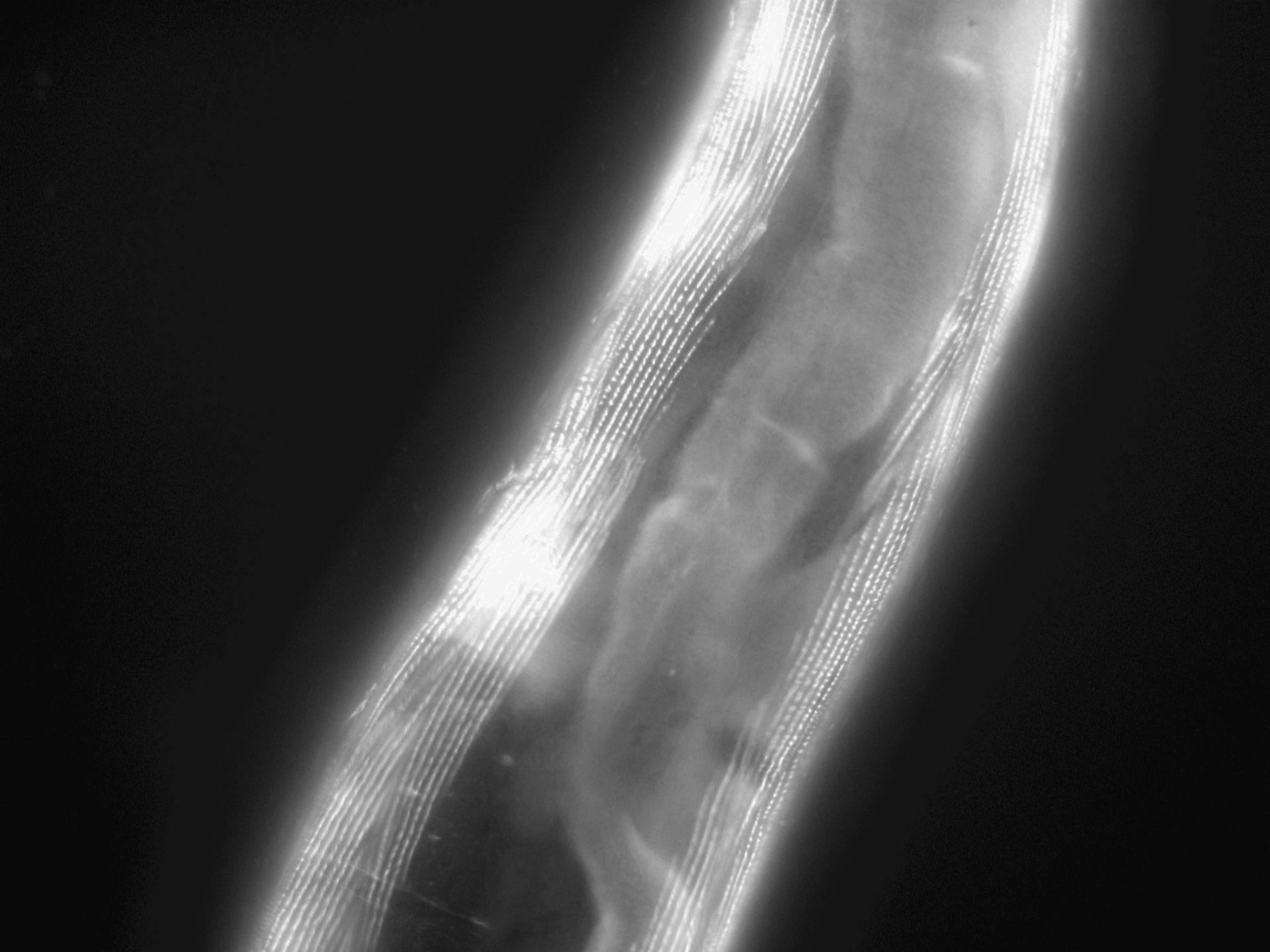 Caenorhabditis elegans (Actin filament) - CIL:1195