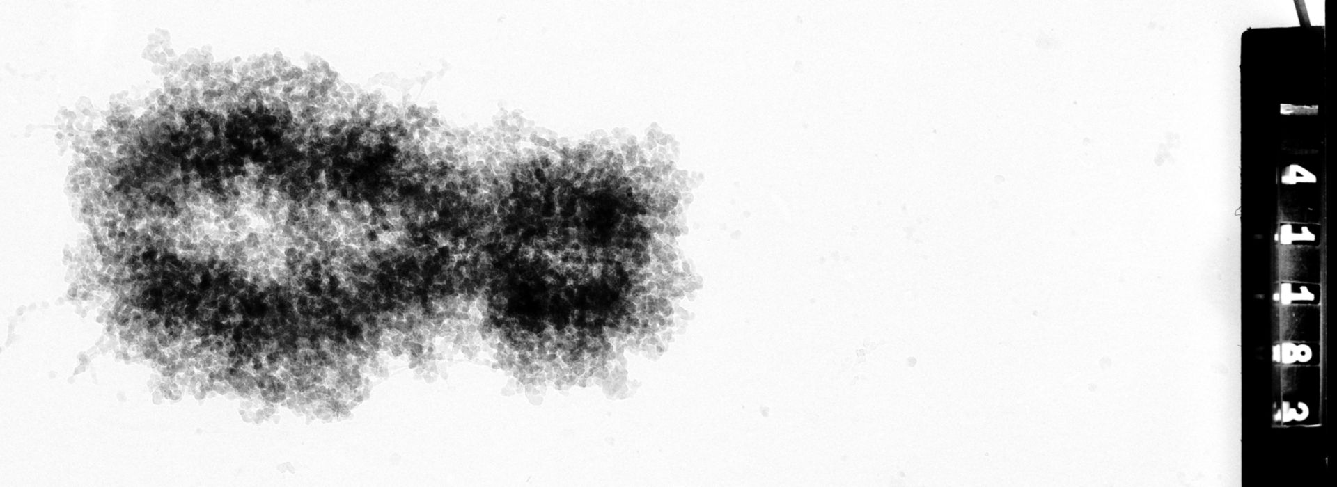 Homo sapiens (Condensed chromosome) - CIL:35372