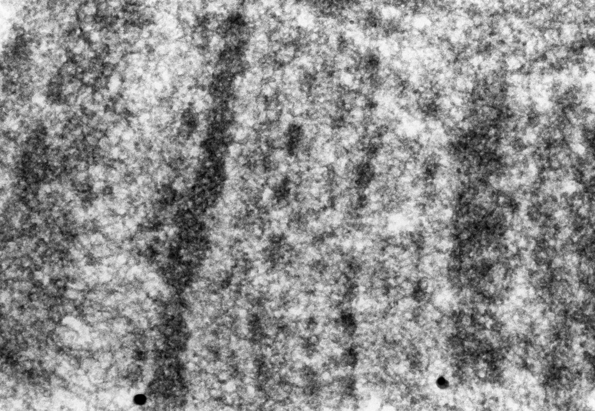 Drosophila melanogaster (Polytene chromosome) - CIL:25322