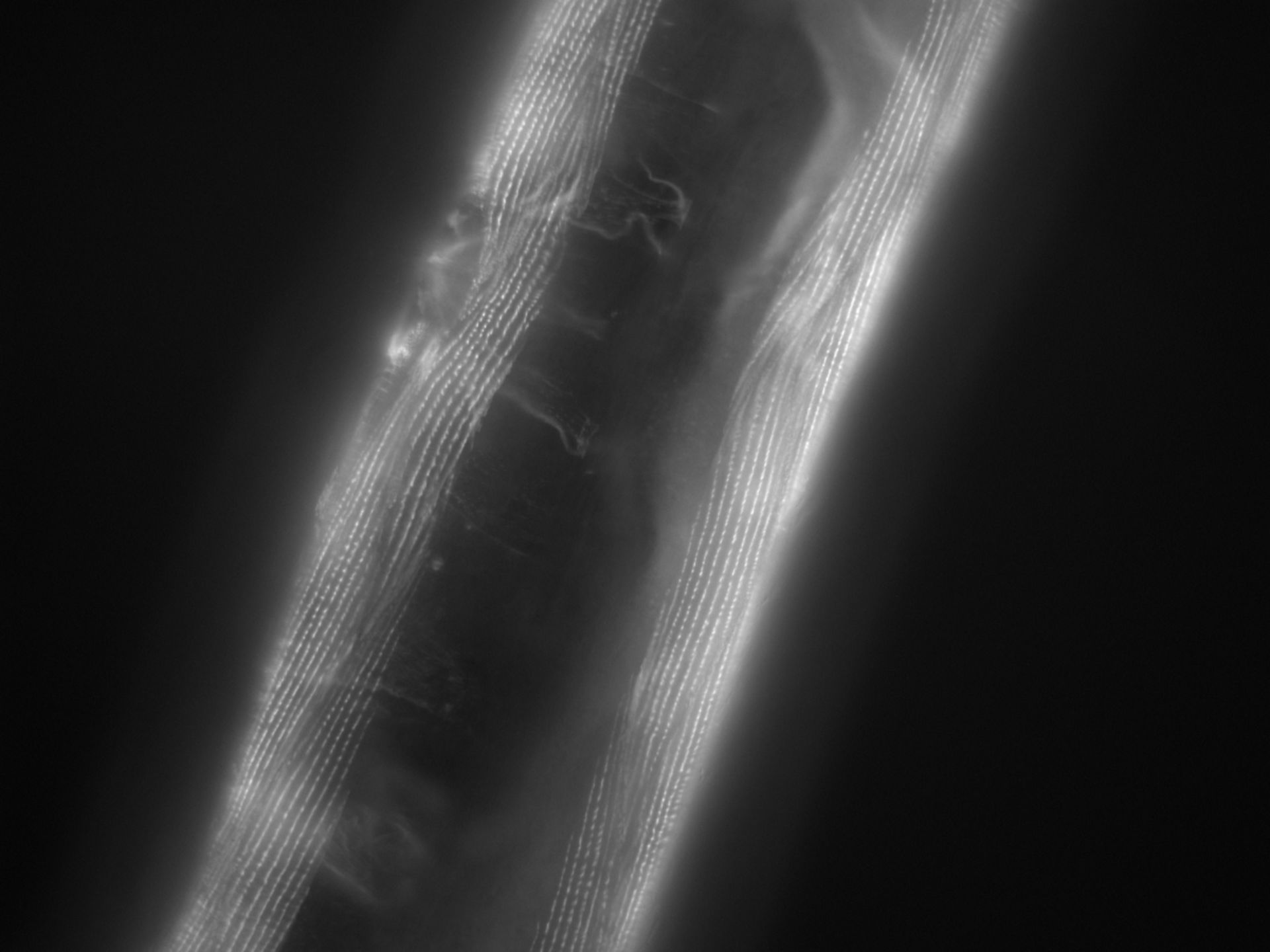 Caenorhabditis elegans (Actin filament) - CIL:1194