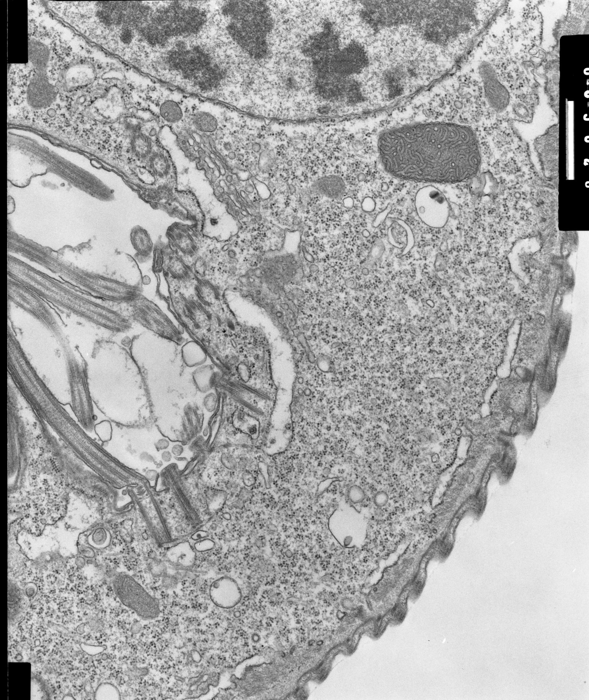 Opercularia coarctata (Golgi) - CIL:7339