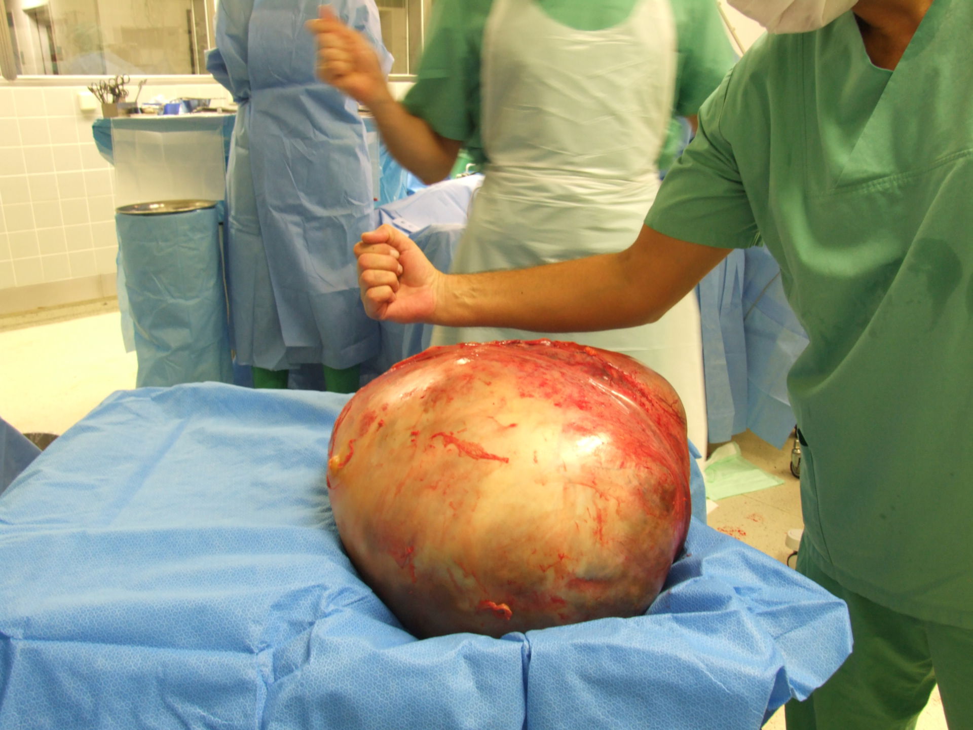 Tumor of the ovary (24 kg/53 lbs)