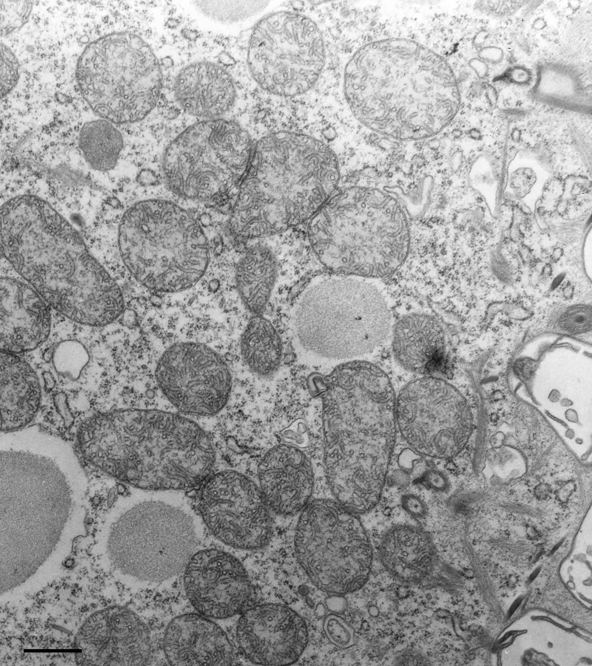 Paramecium multimicronucleatum (Cytoplasm) - CIL:36629
