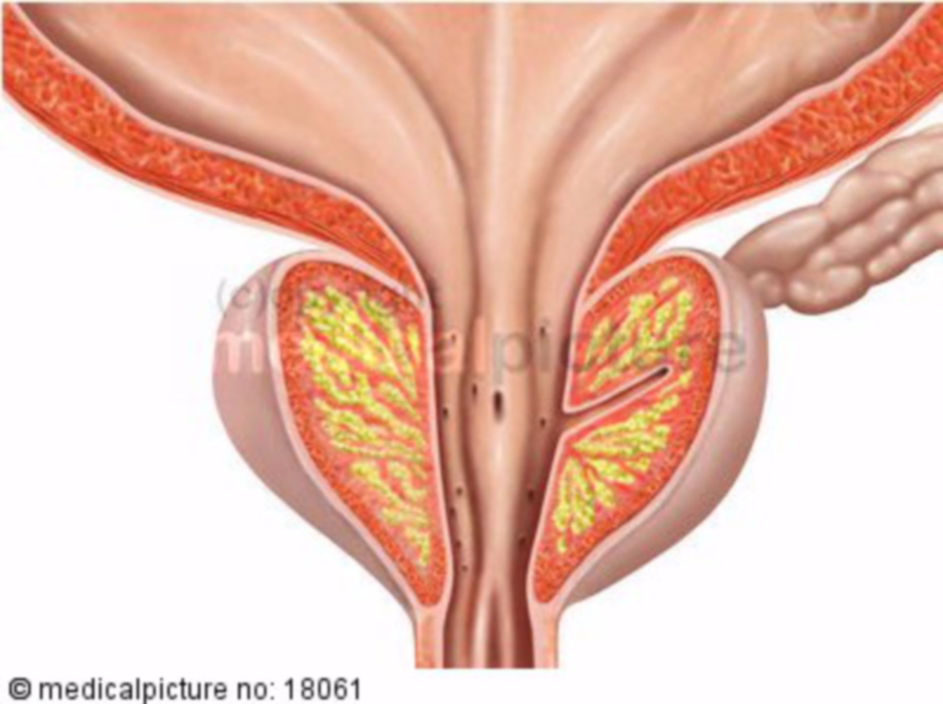 Längsschnitt der Prostata, Vorsteherdrüse