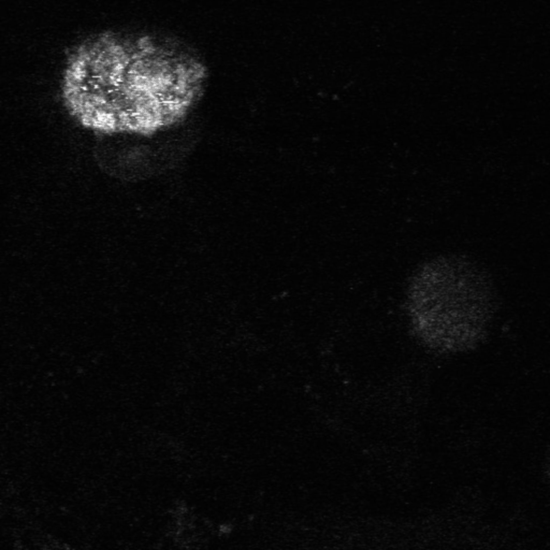 Xenopus laevis (Axon) - CIL:37040