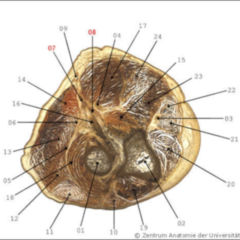 Foveola radialis DocCheck Flexikon