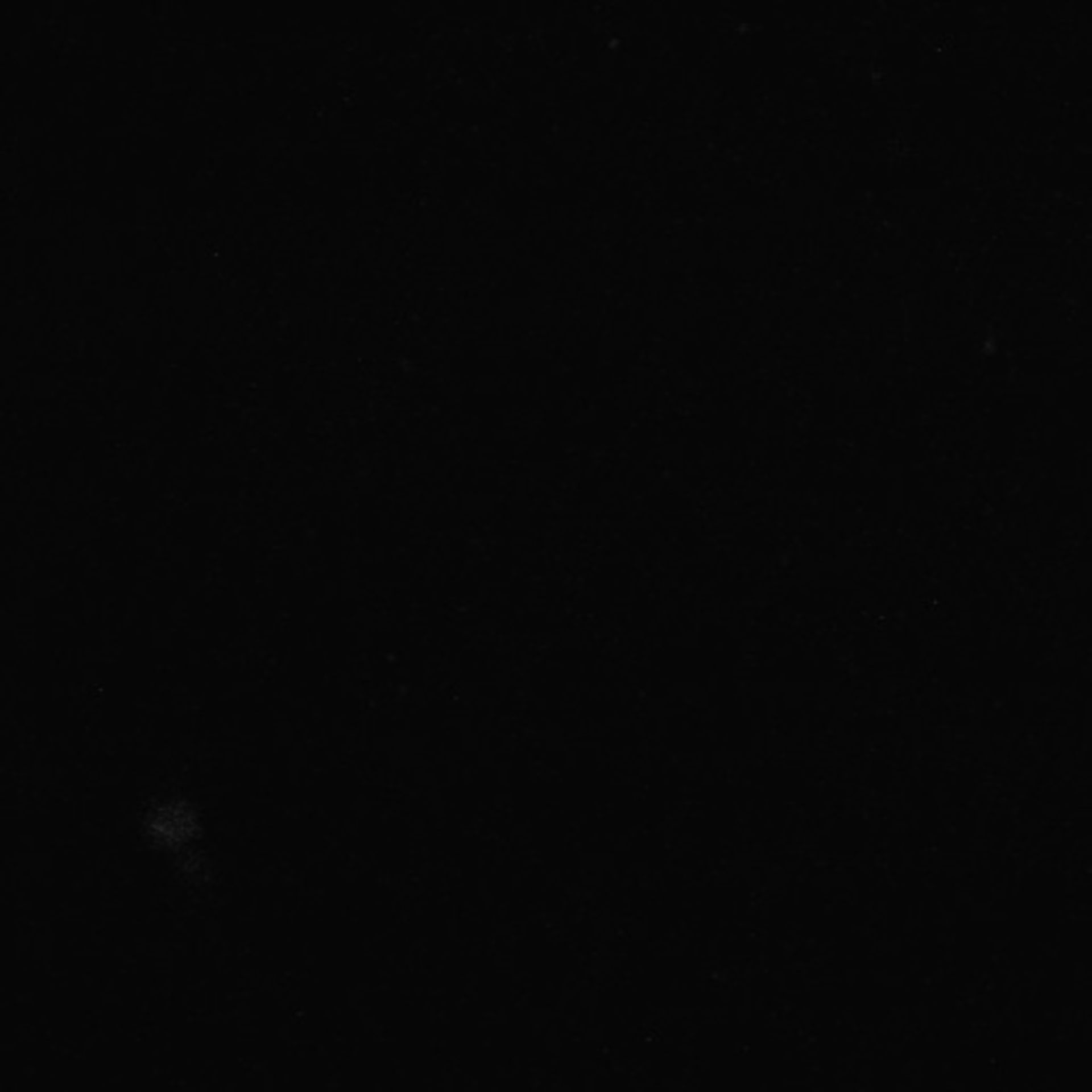 Xenopus laevis (Neuronal cell body) - CIL:37011