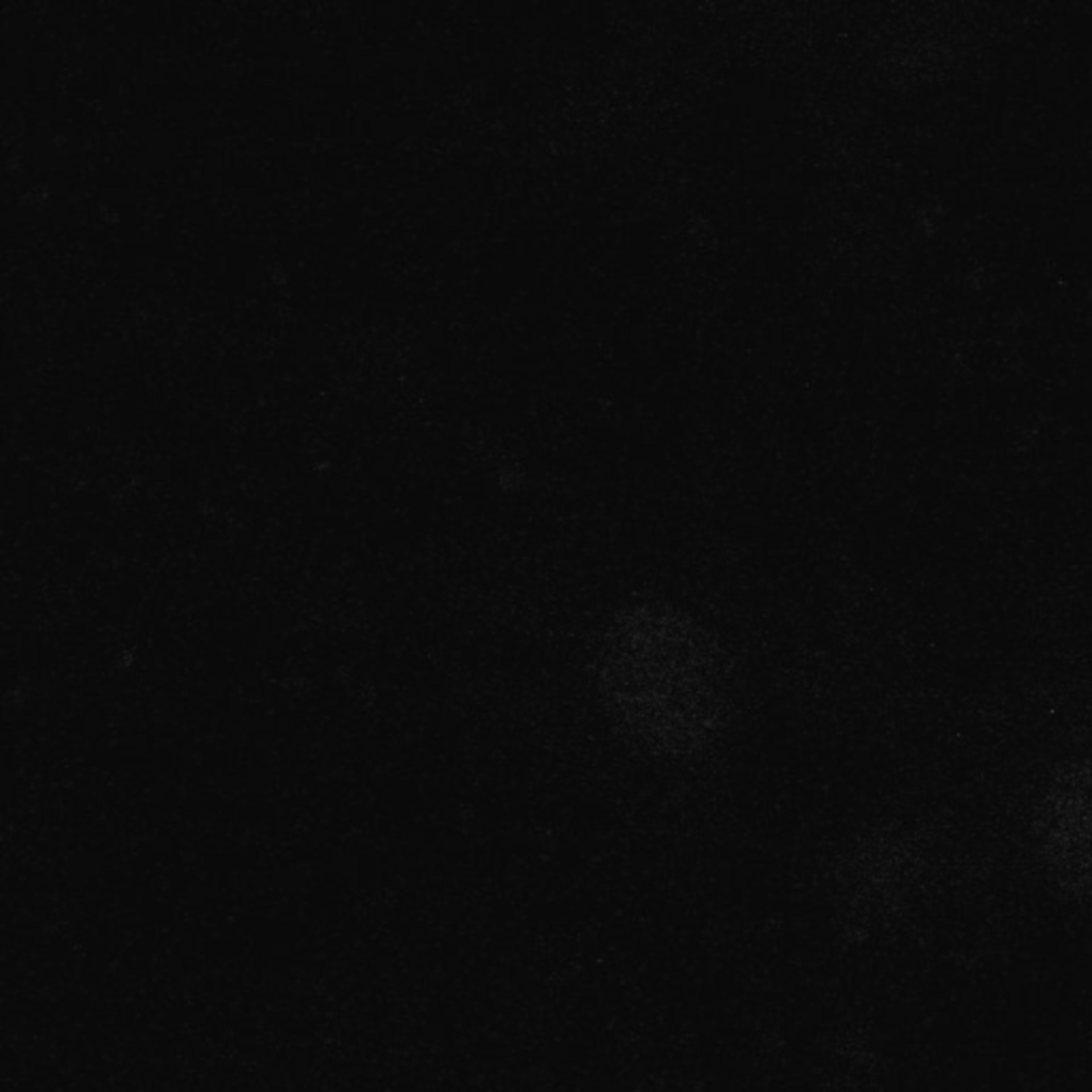 Xenopus laevis (Axon) - CIL:36867