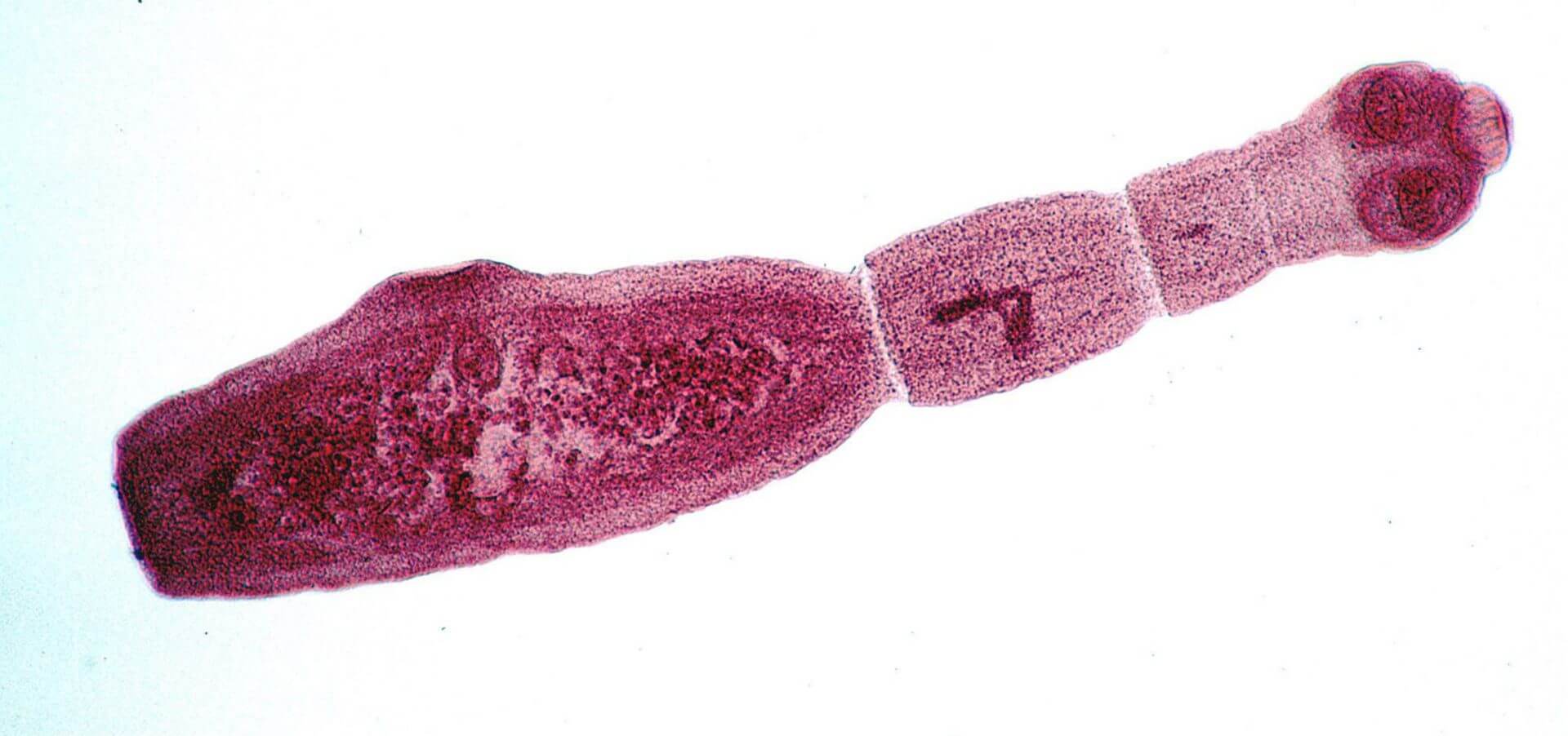 Echinococcus multilocularis