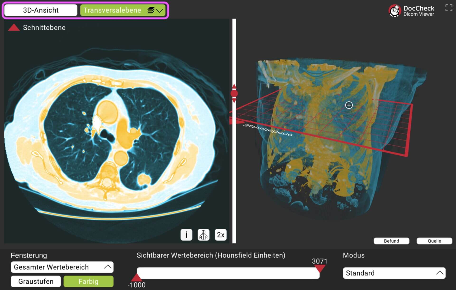 DICOM-Viewer: Ansicht