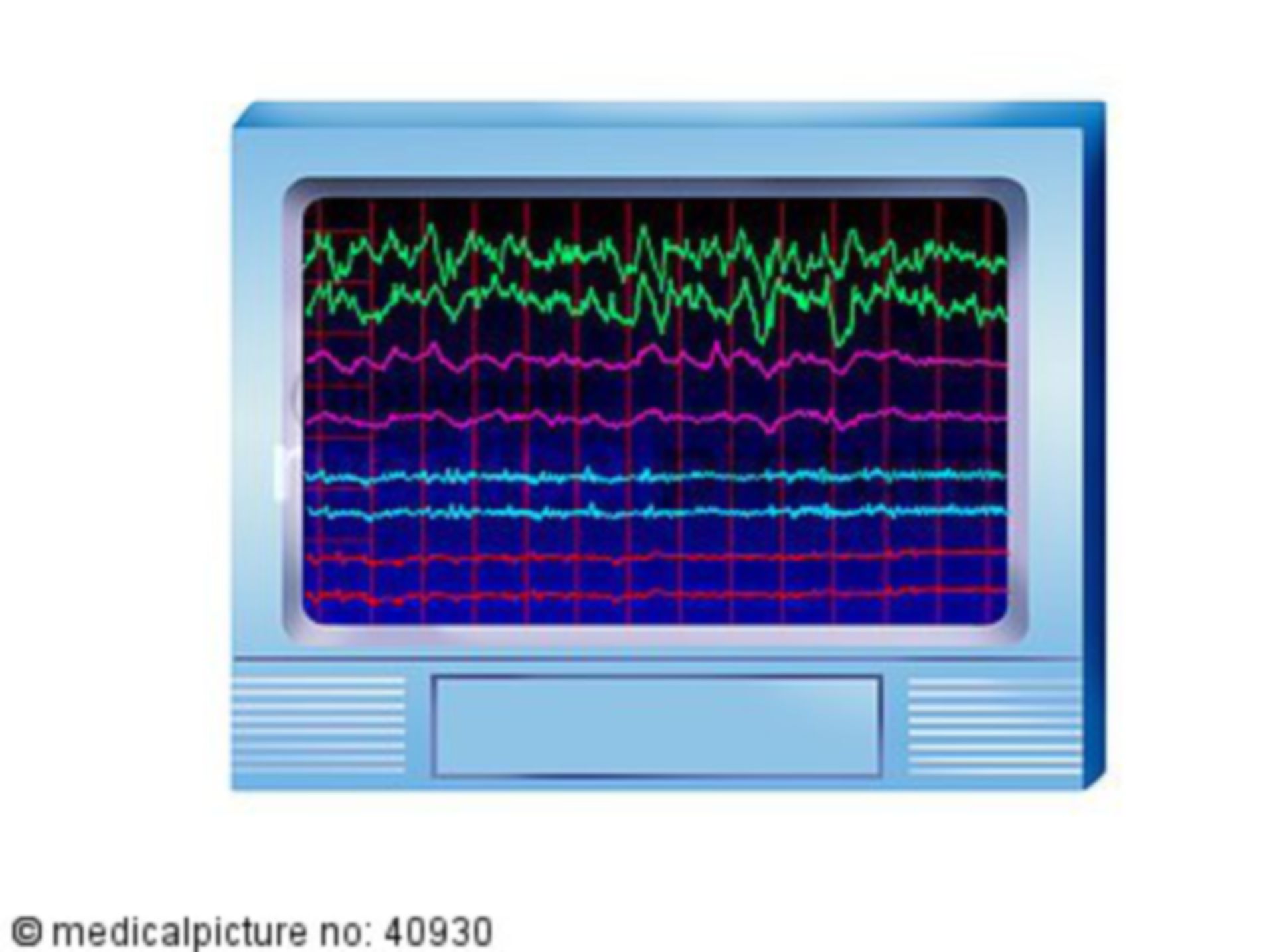  EEG, 8 Ableitungen, Normalbefund, electroaencephalography 
