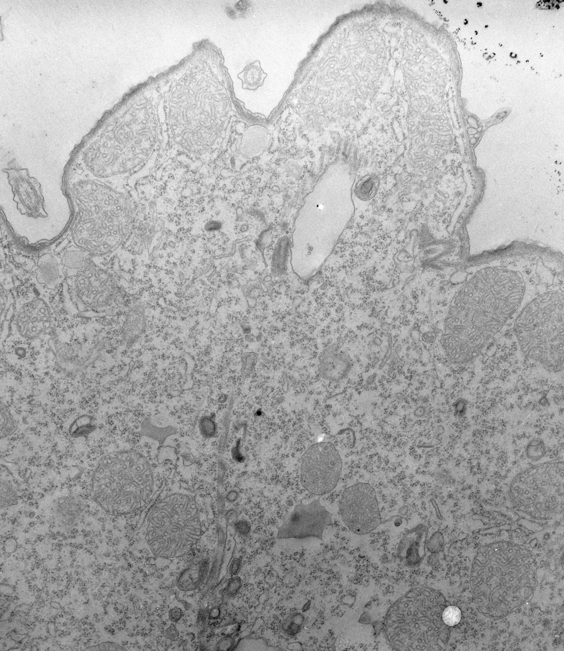 Tetrahymena pyriformis (Acidosome) - CIL:39725