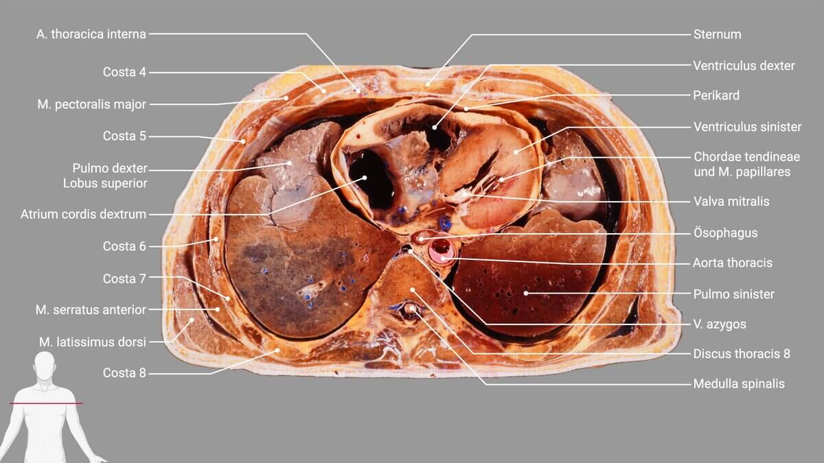 Schnittbildpräparat Thorax