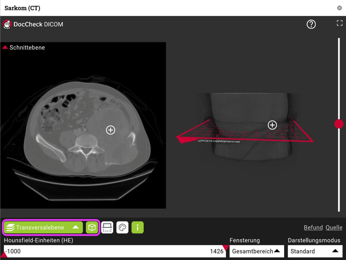 DICOM-Viewer 2