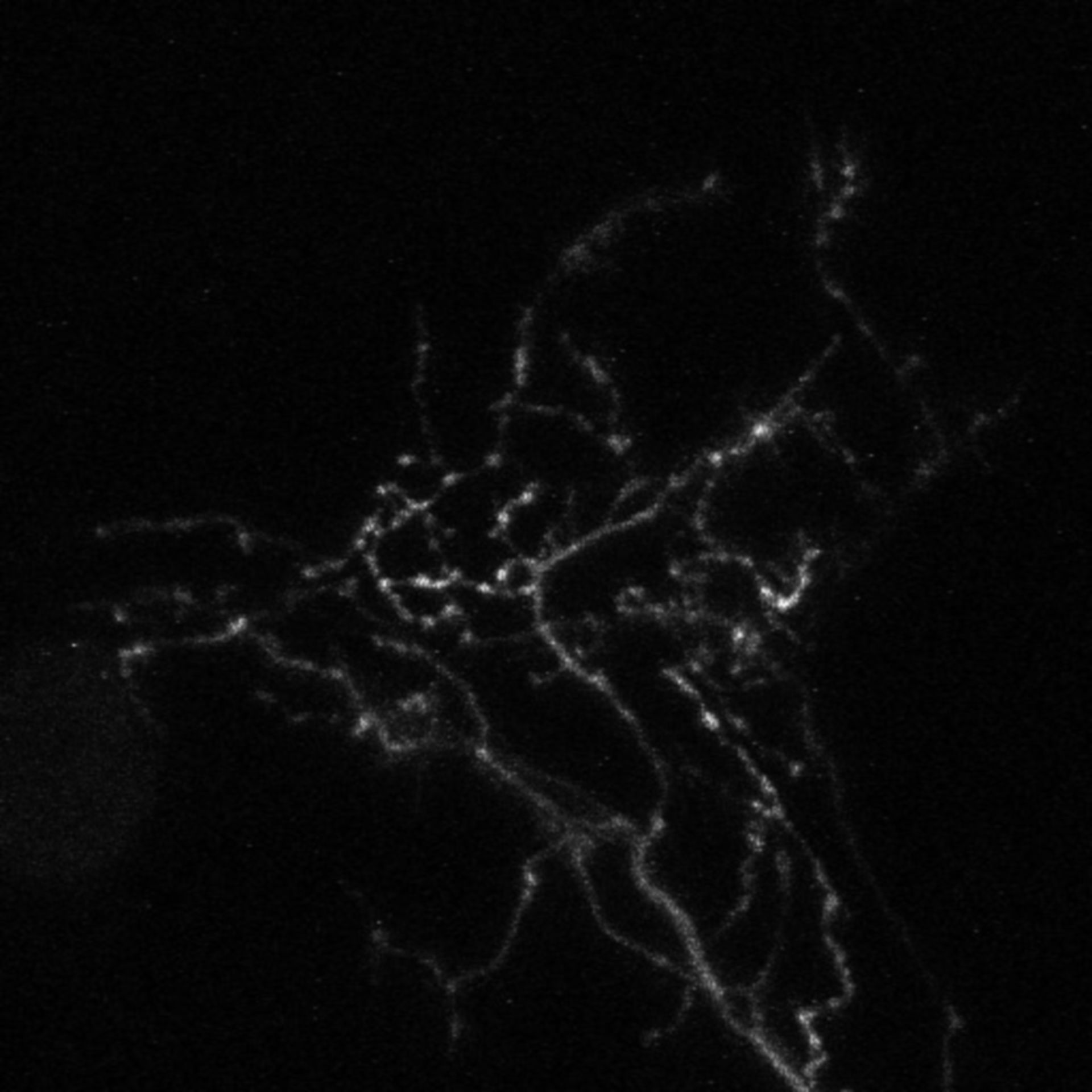 Xenopus laevis (Axon) - CIL:37029