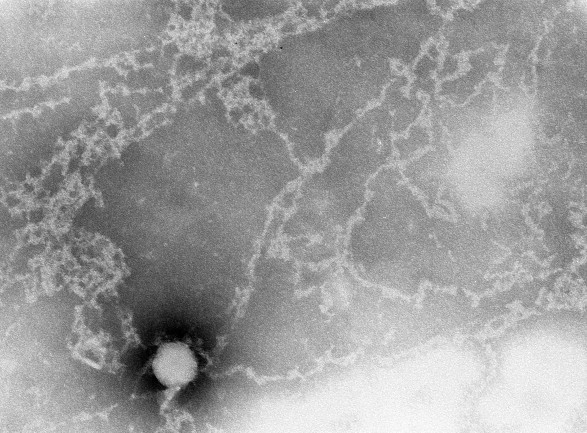 Notopthalmus viridescens (Nuclear chromatin) - CIL:9528