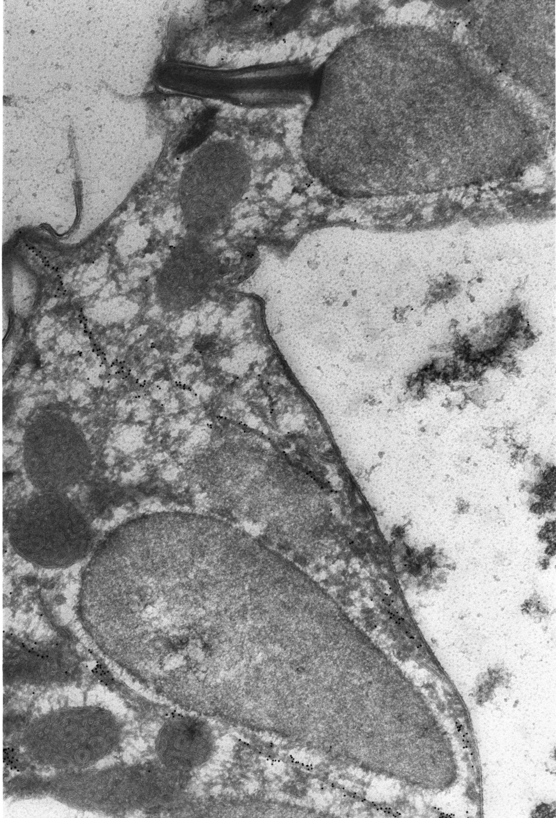 Paramecium tetraurelia (Trichocyst) - CIL:1308