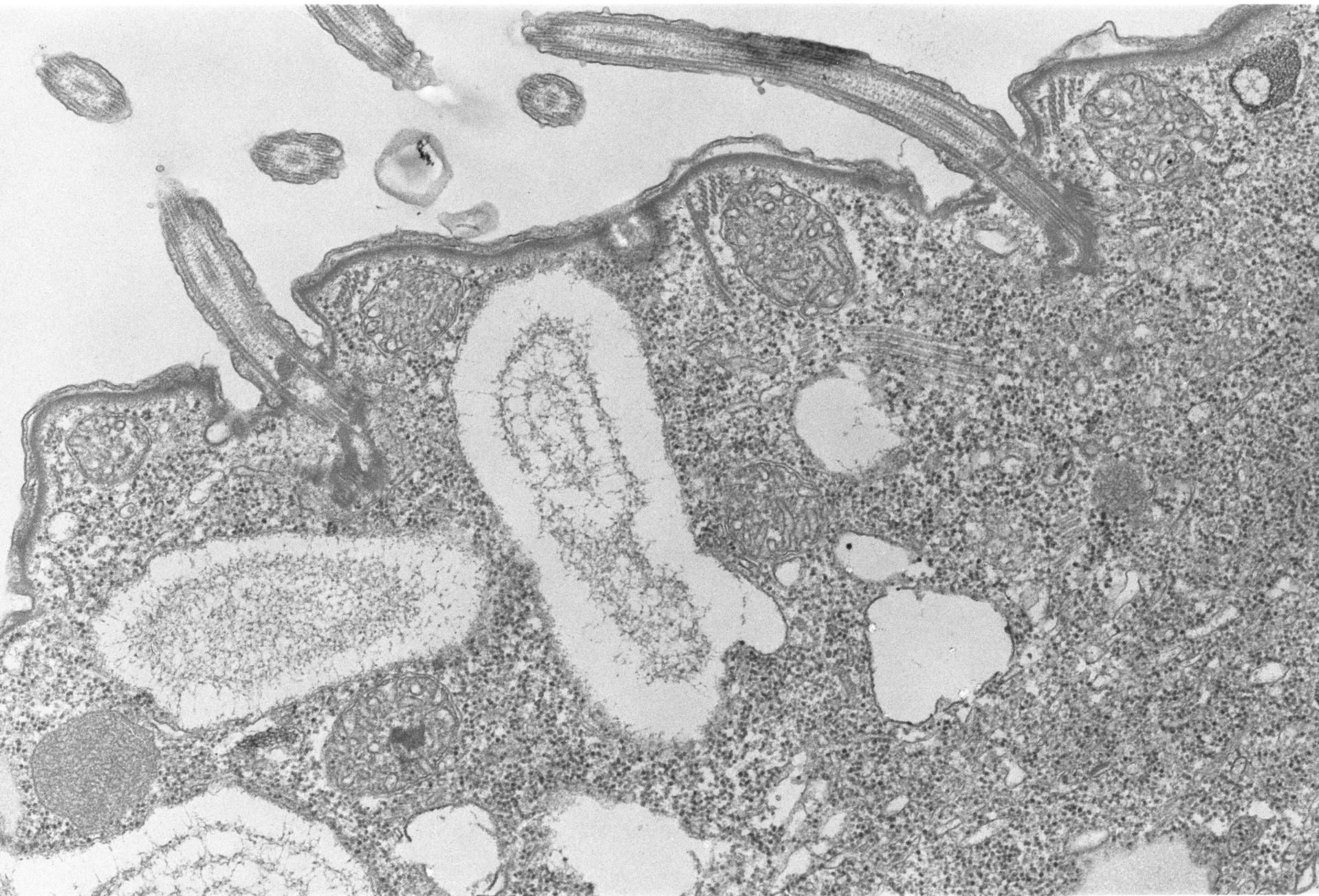 Colpoda cucullus (Cell cortex) - CIL:2859