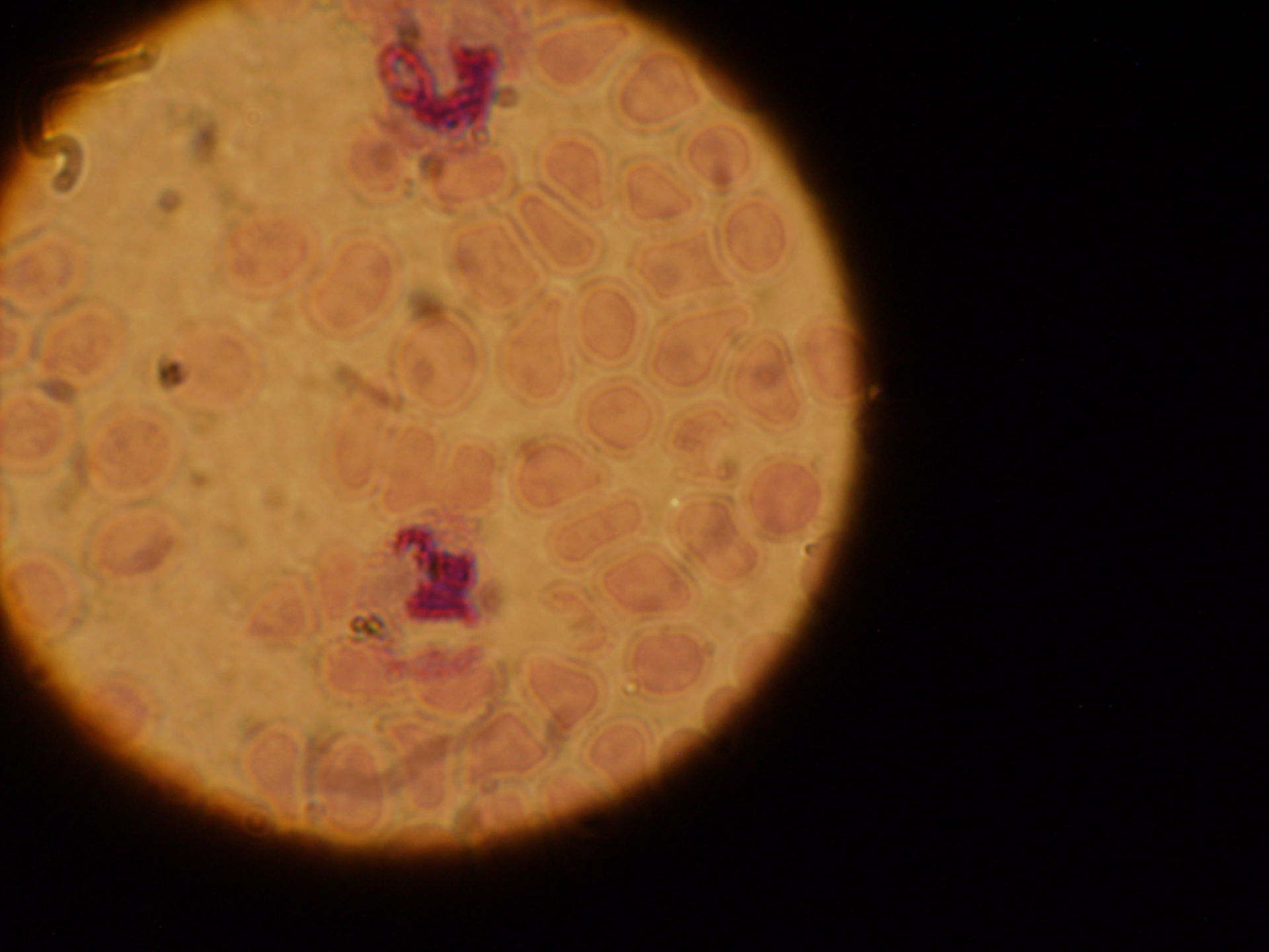 Plasmodium ovale schizonti