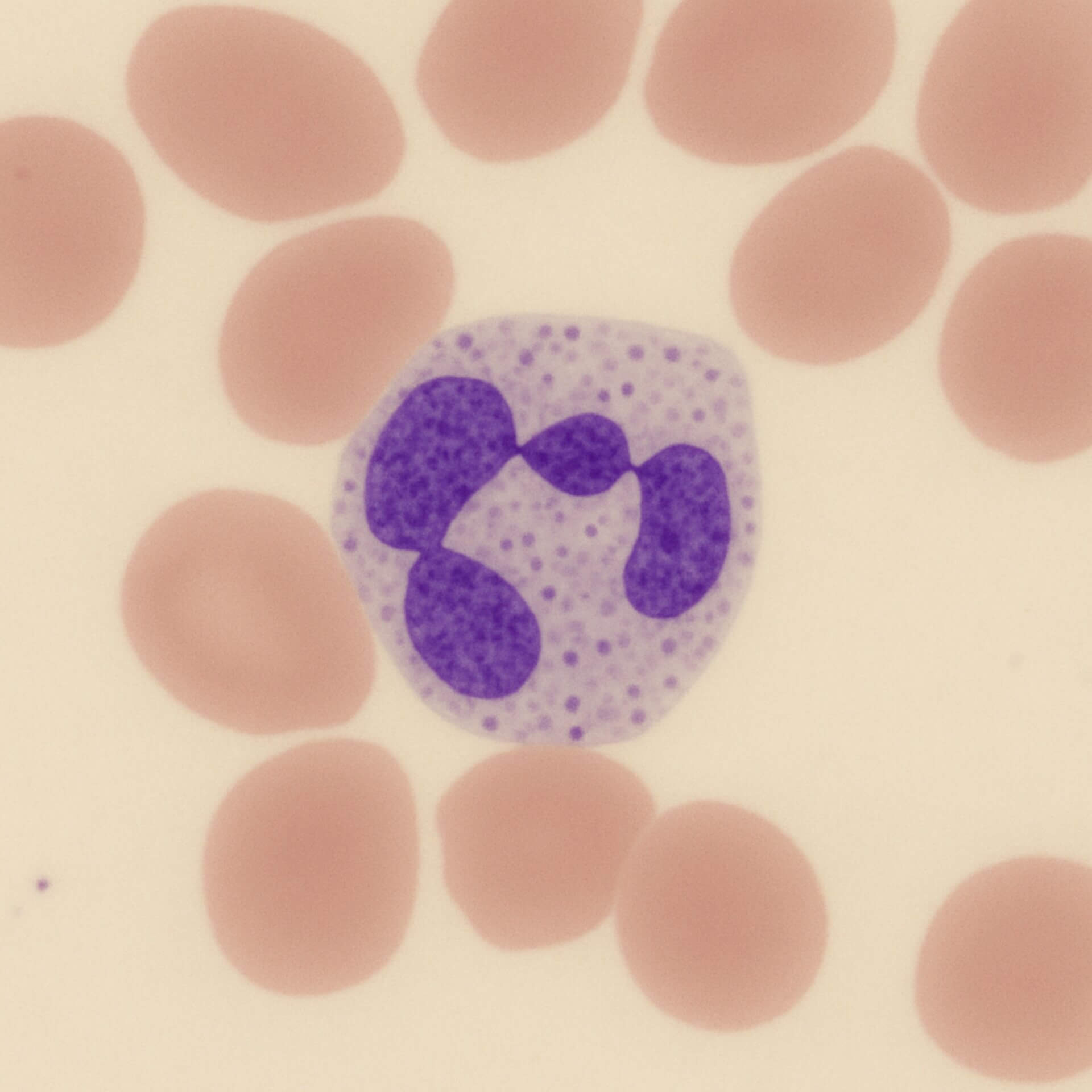 Segmentkerniger Granulozyt