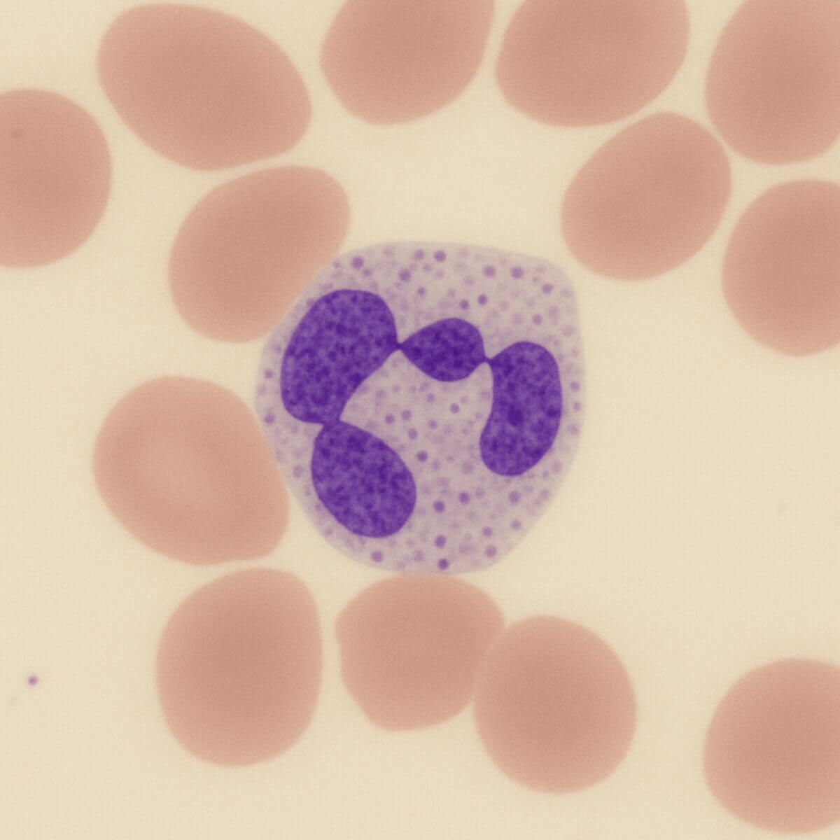 Segmentkerniger Granulozyt