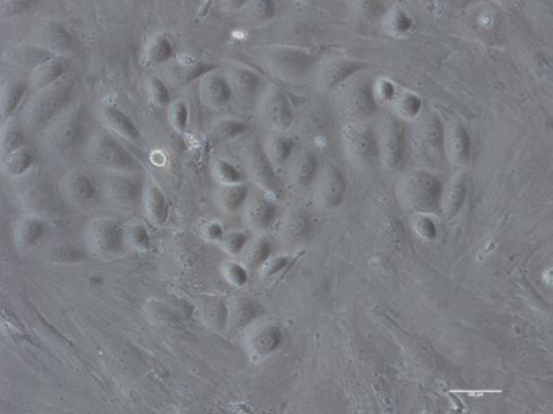 Mesenchymale Stammzellen aus dem Fettgewebe