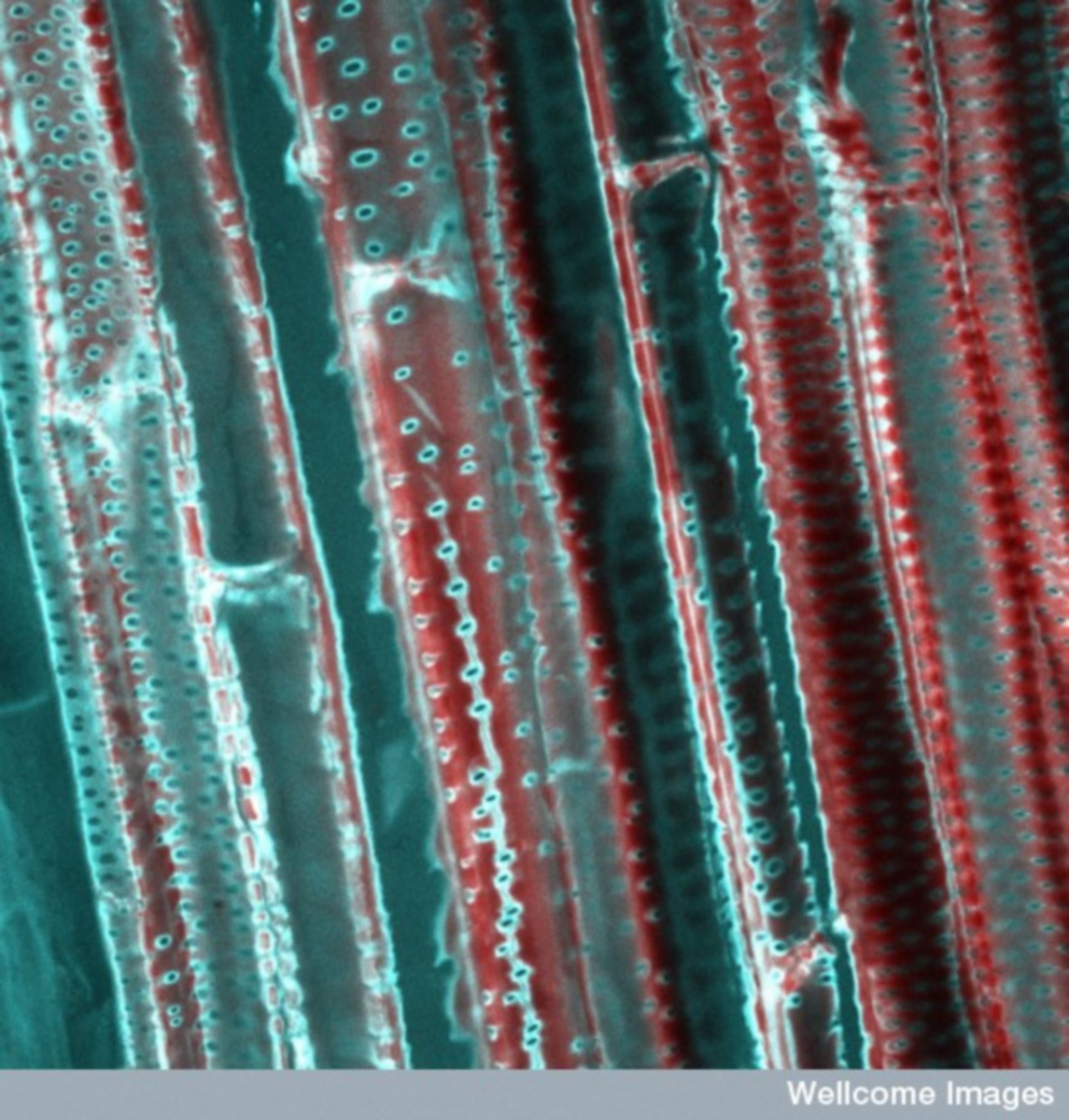 Mikroskopische Aufnahme des Xylems