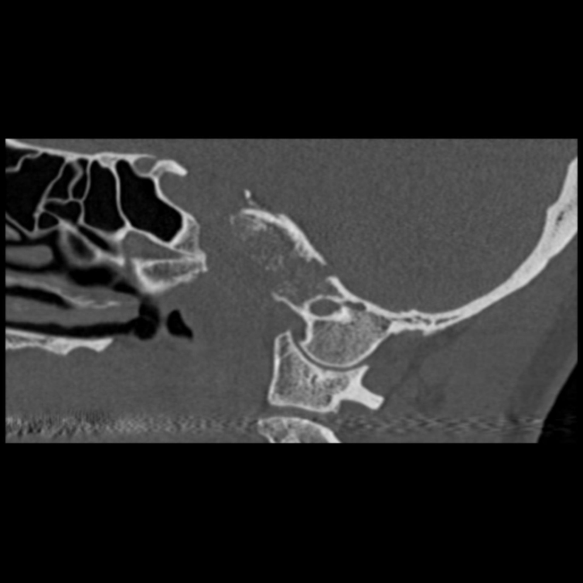 ct_sag100001: Ausschnitt eines Kopf-CTs