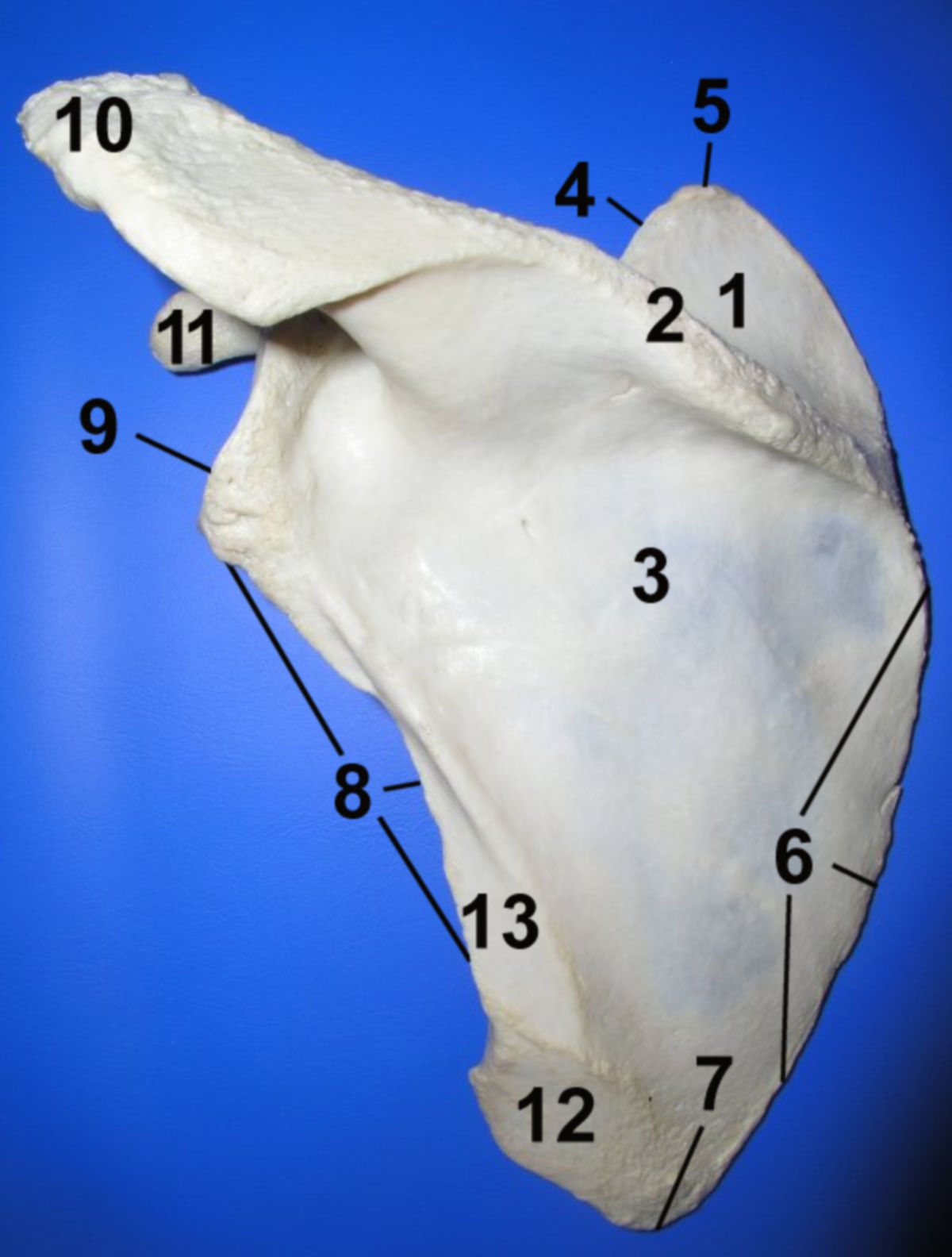 Scapula: Facies dorsalis (Rückseite)