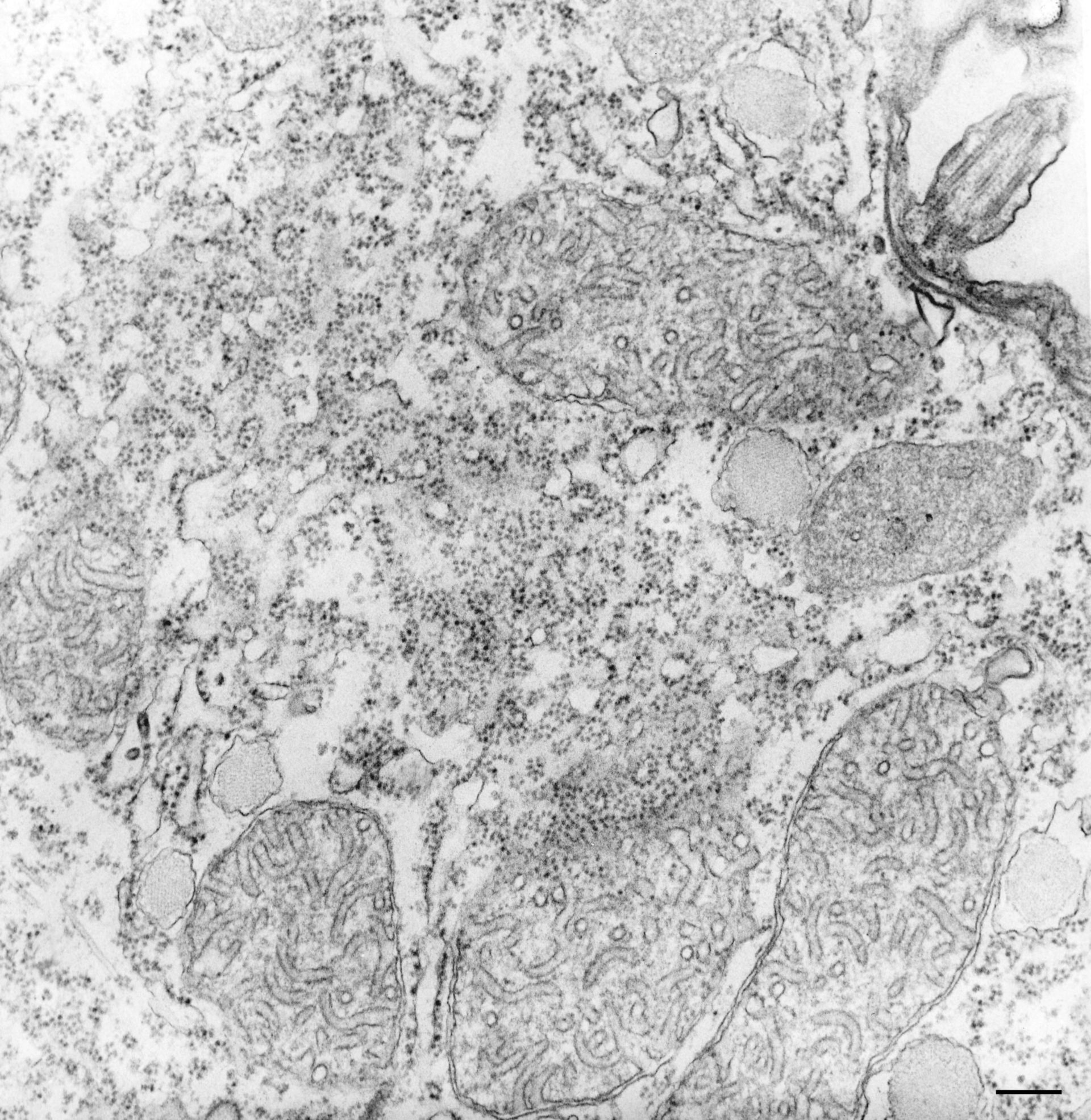 Tetrahymena pyriformis (Polysomal ribosome) - CIL:34618