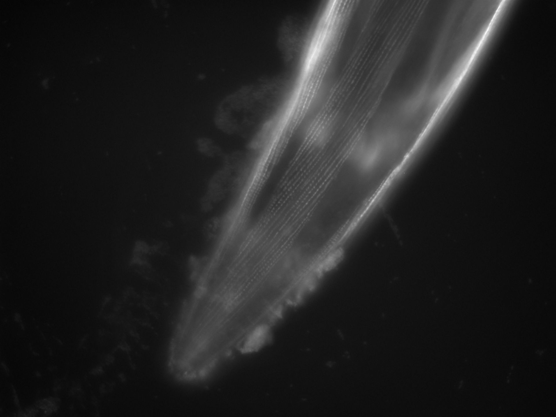 Caenorhabditis elegans (Actin filament) - CIL:1112