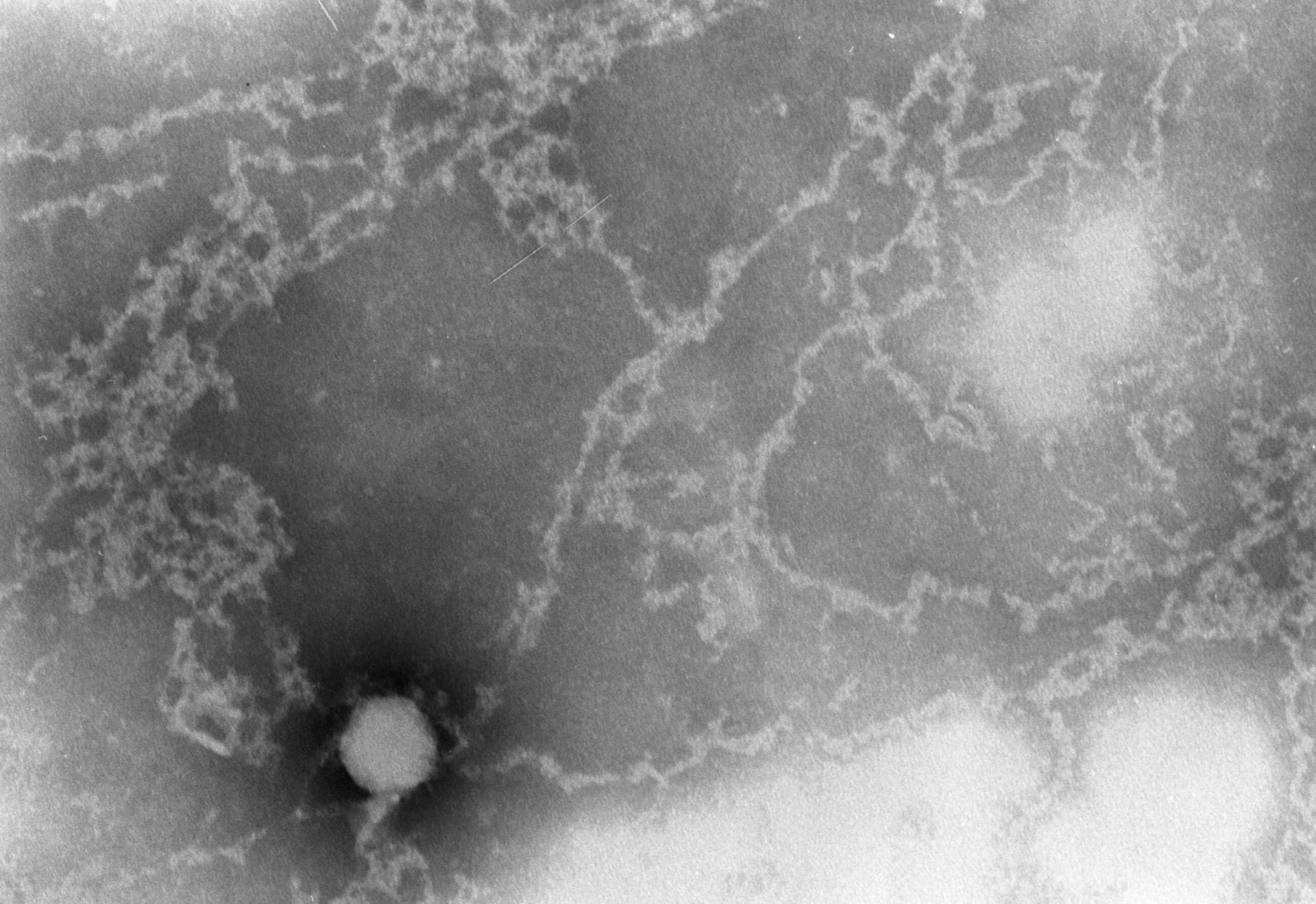Notopthalmus viridescens (Nuclear chromatin) - CIL:9527