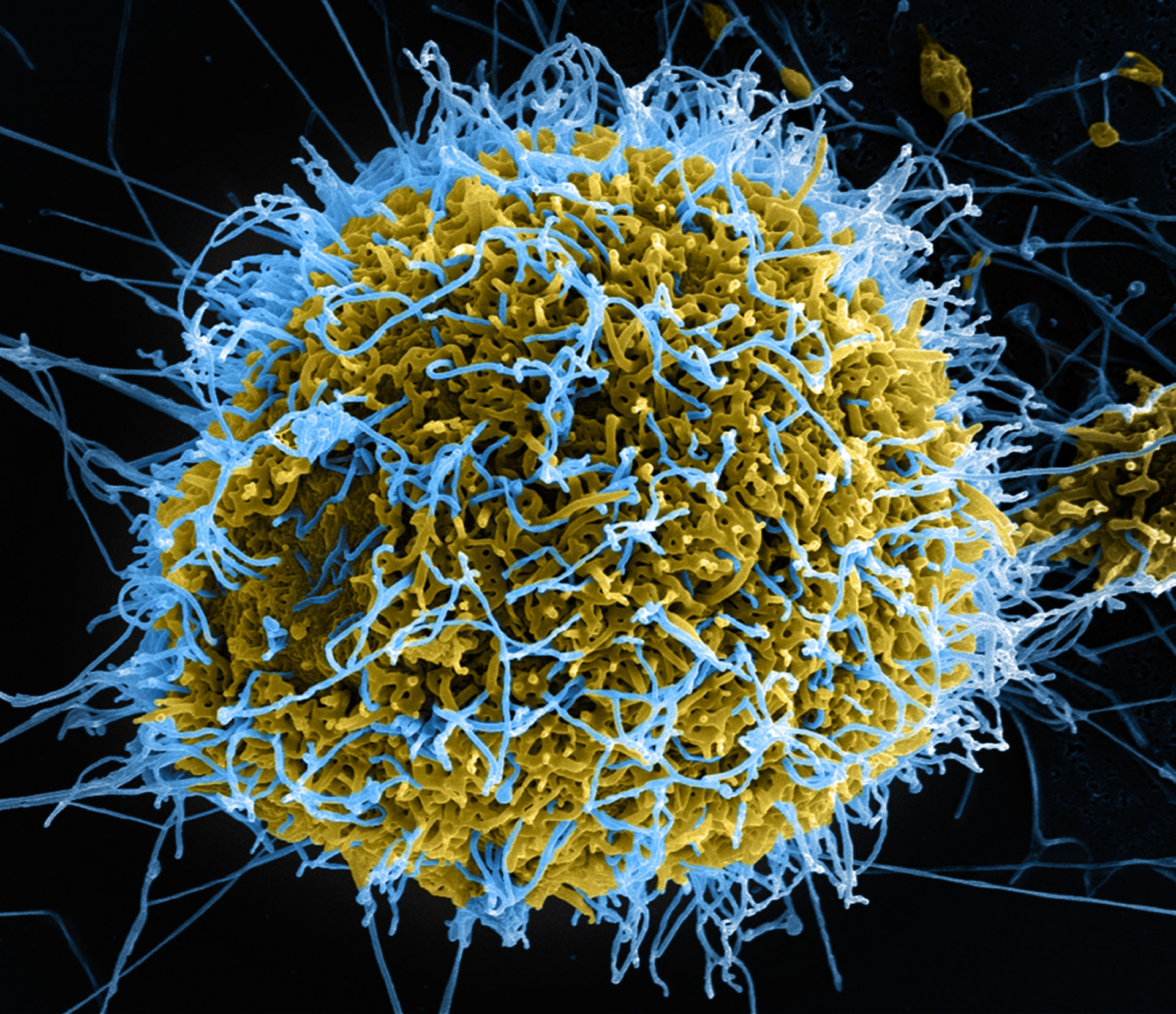 Partículo del virus de ebola