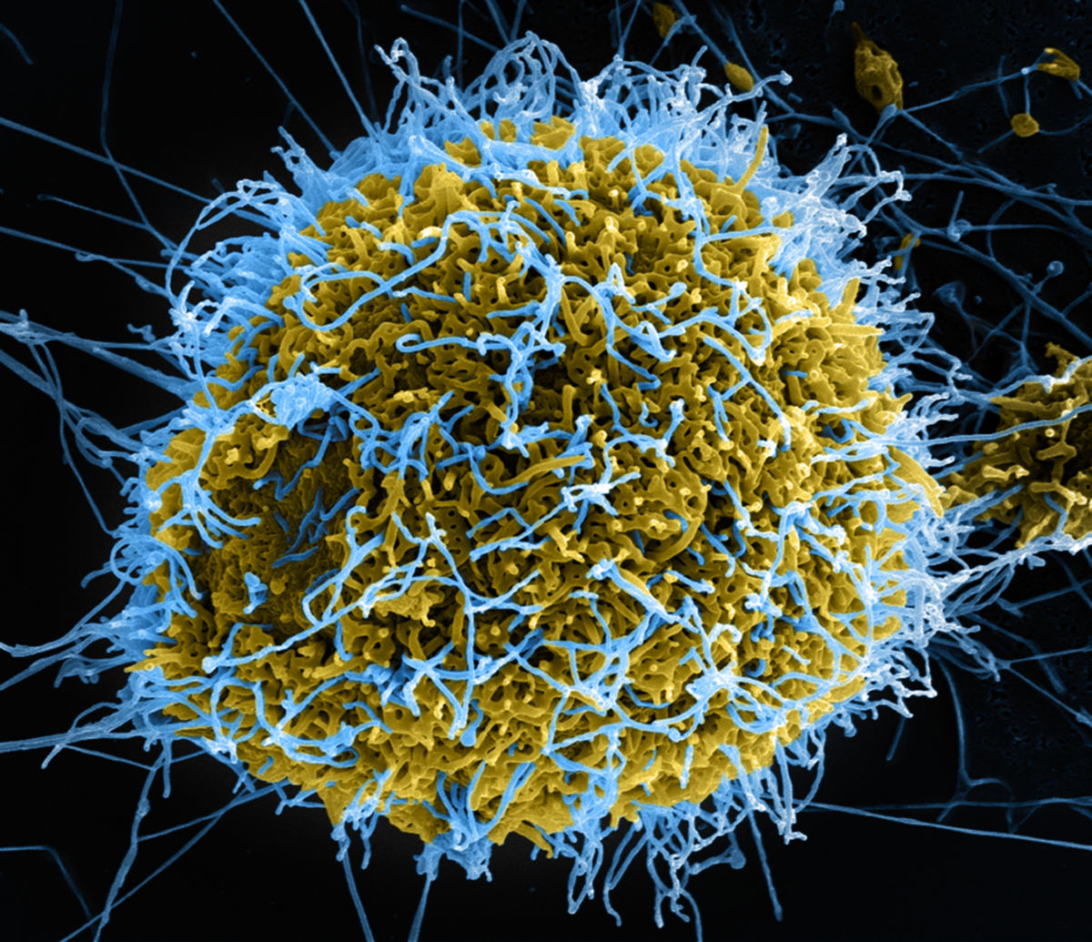 Ebolavirus-Partikel