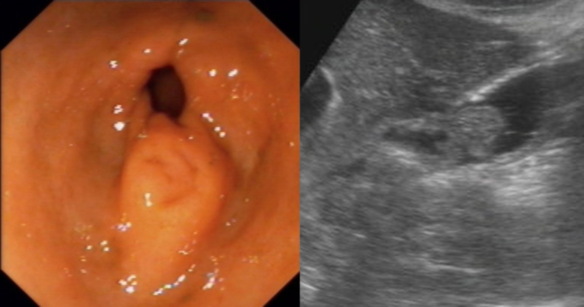 Hydrosonography