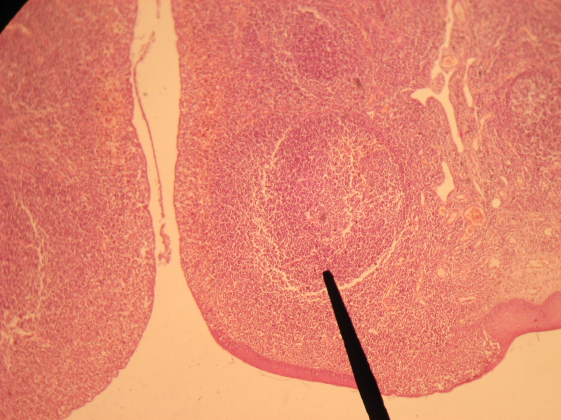 Gaumenmandel des Hundes (3) - Lymphknoten mit Randwall