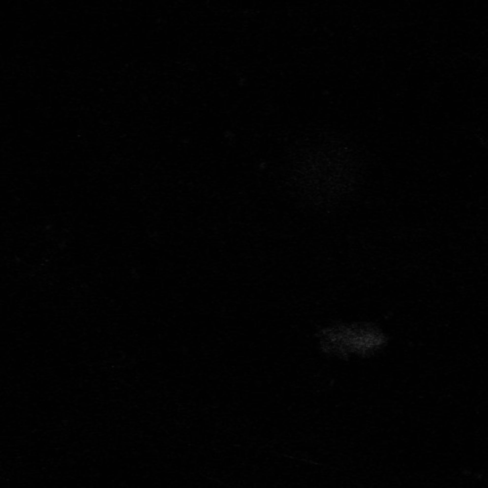 Xenopus laevis (Neuronal cell body) - CIL:37046