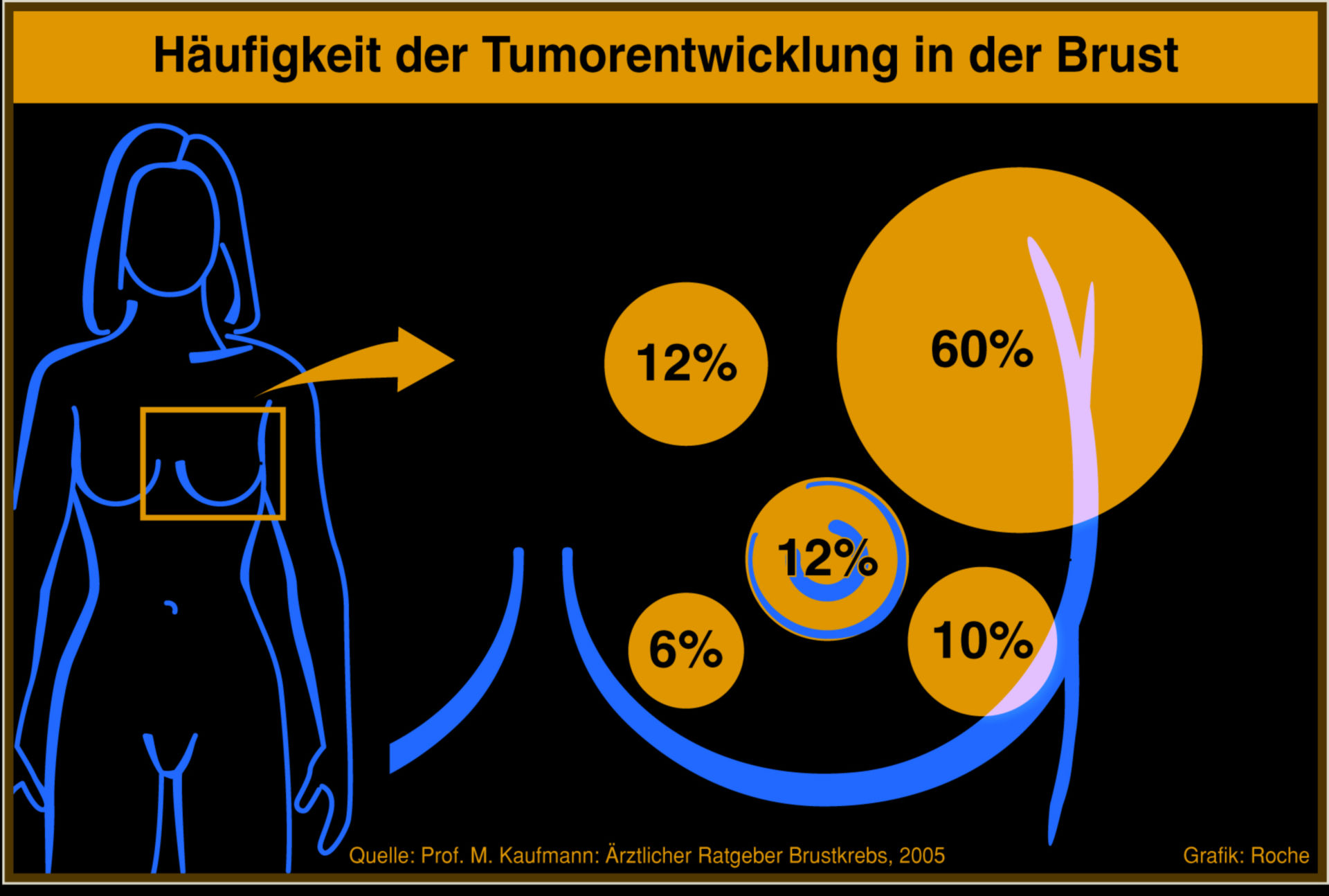 Frequency of tumor devolopment in the breast