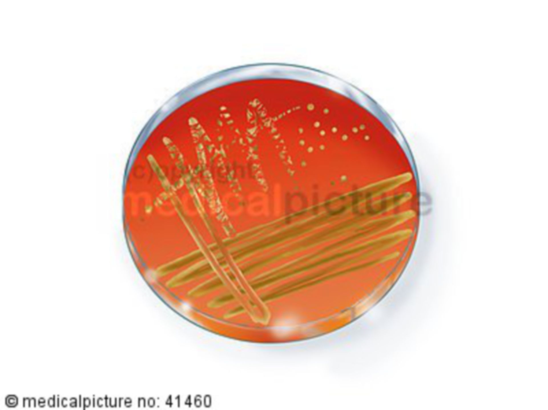 Grafik Petri-Schale, graphic of a Petri dish 
