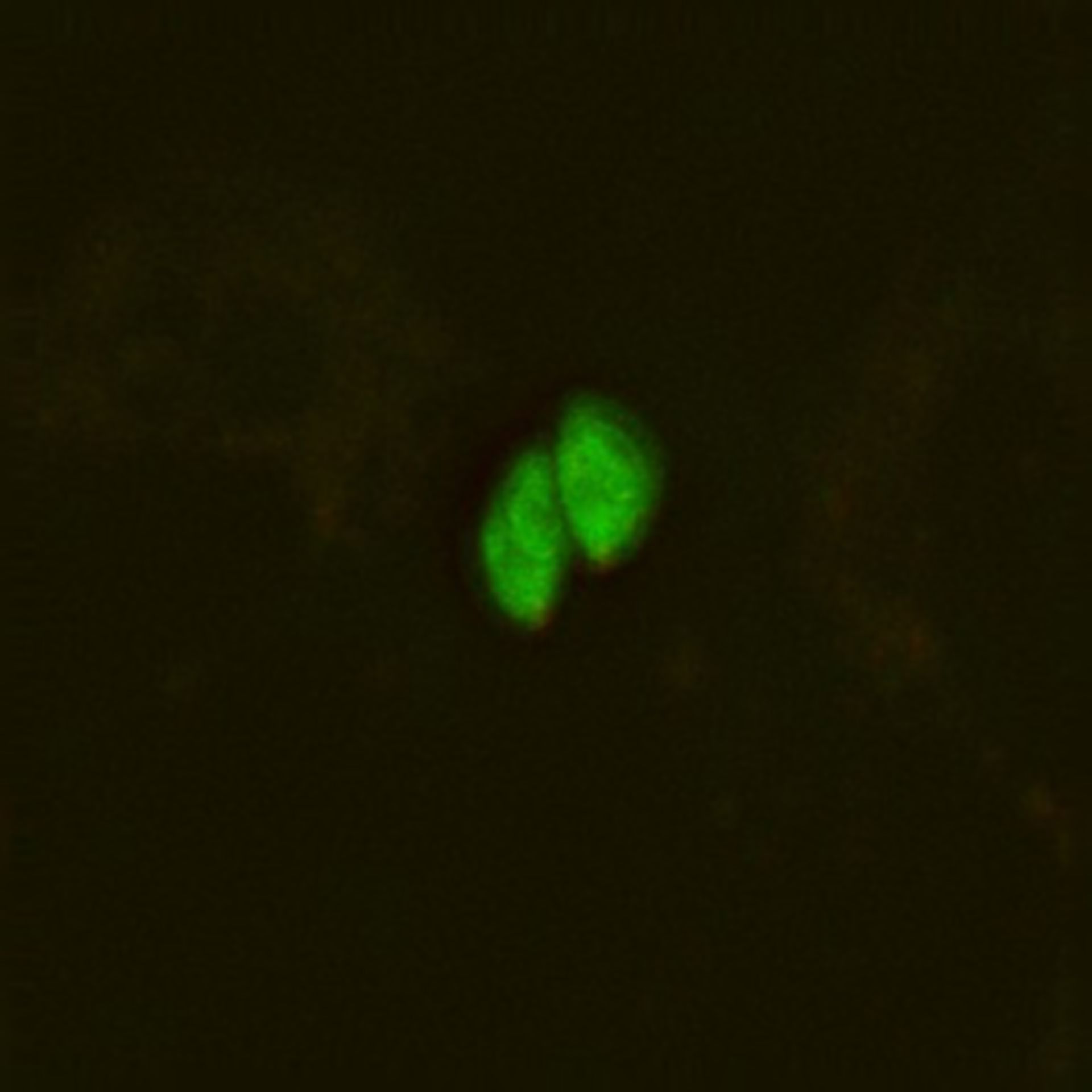 Toxoplasma gondii RH (Microtubule organizing center) - CIL:10455