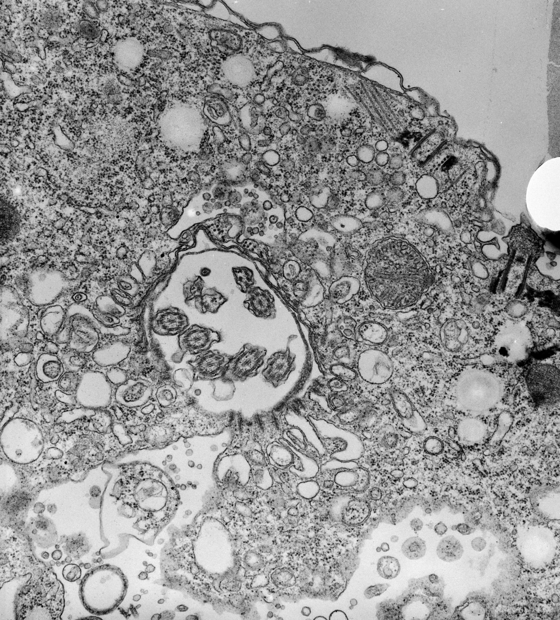 Halteria grandinella (Cortical microtubule cytoskeleton) - CIL:7612