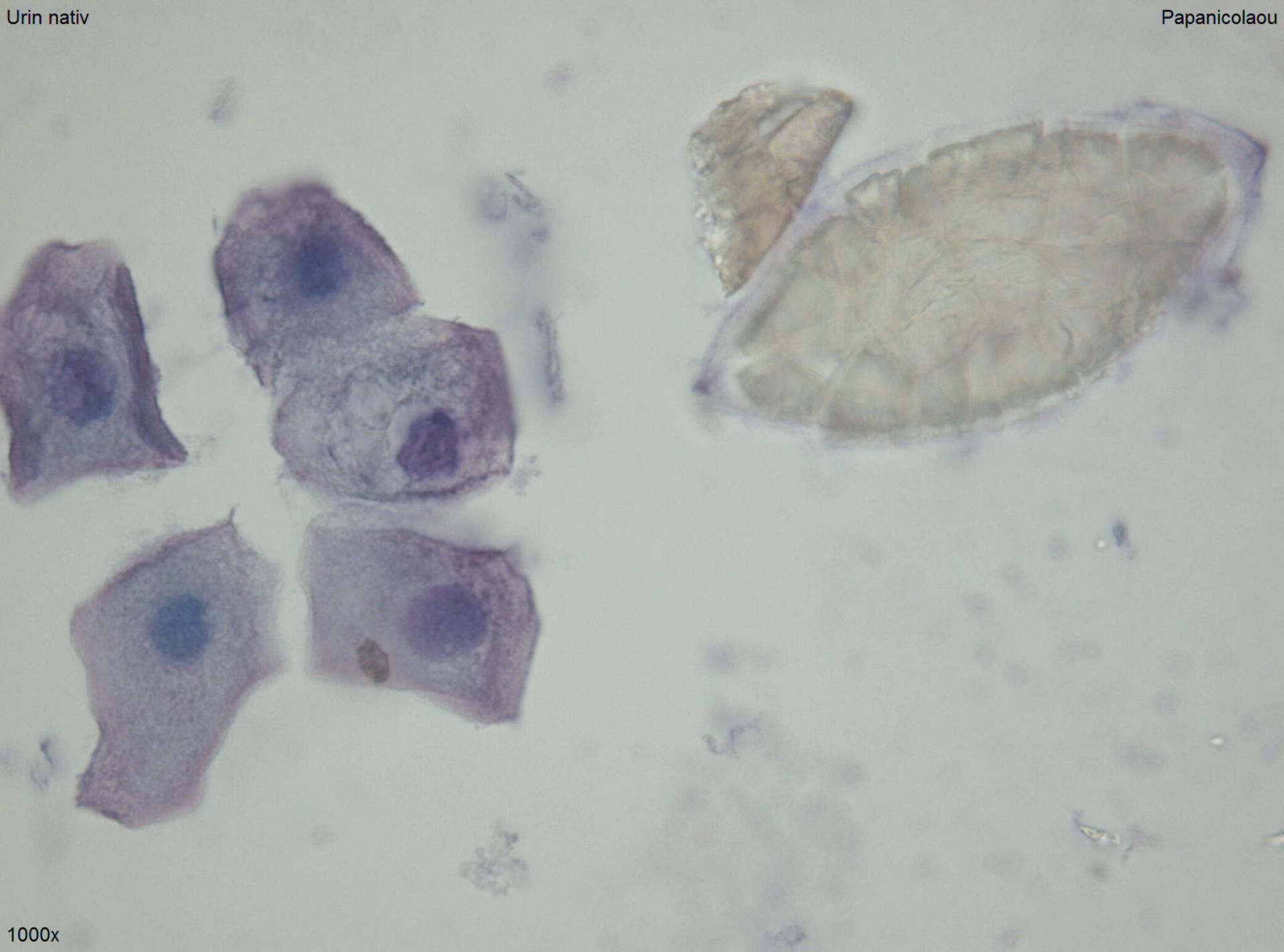 Schistosomeneier oder Pollen 3