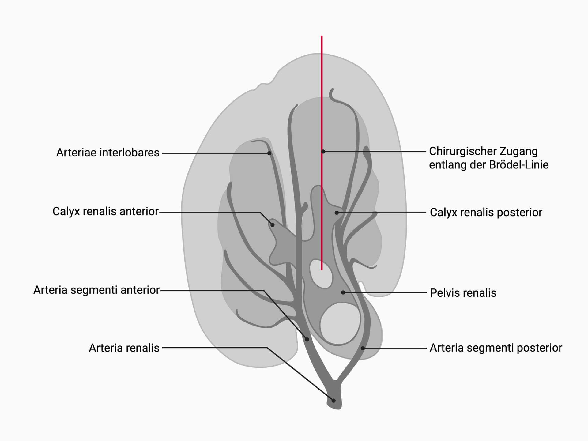 Chirurgischer Zugang entlang der Brödellinie