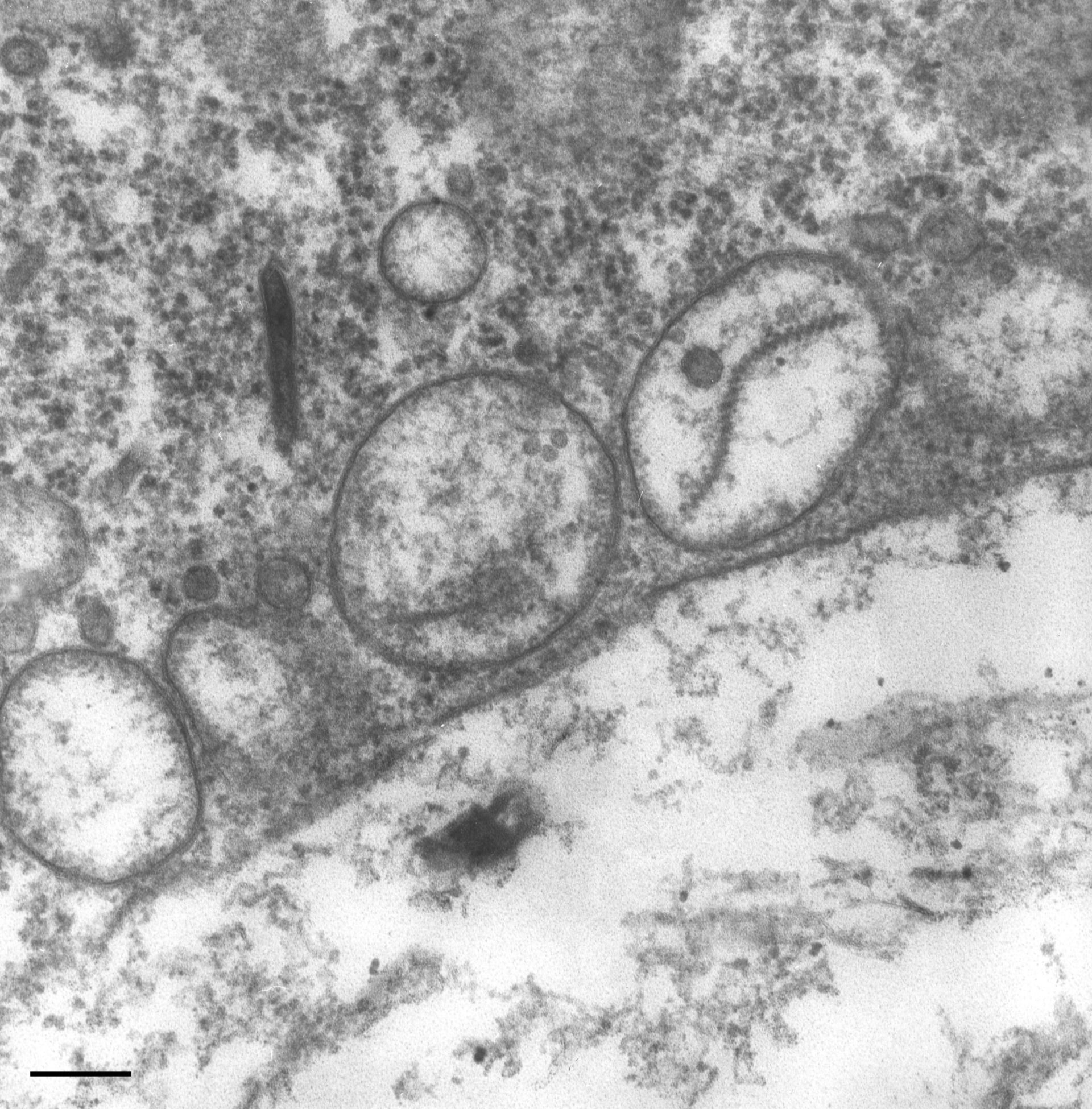 Paramecium multimicronucleatum (Primary lysosome) - CIL:36739