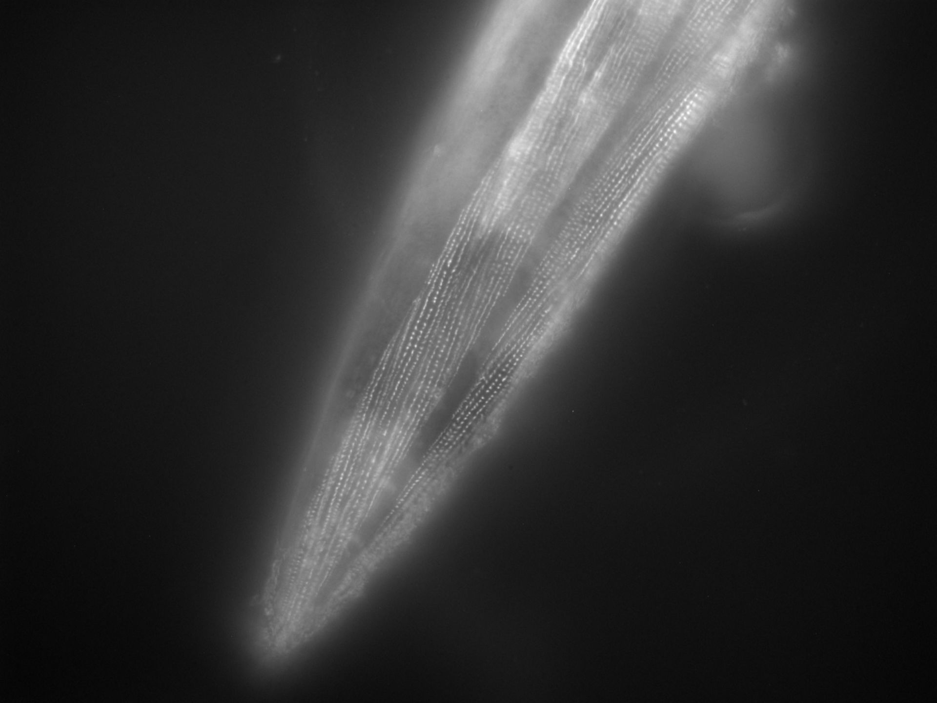 Caenorhabditis elegans (Actin filament) - CIL:1106