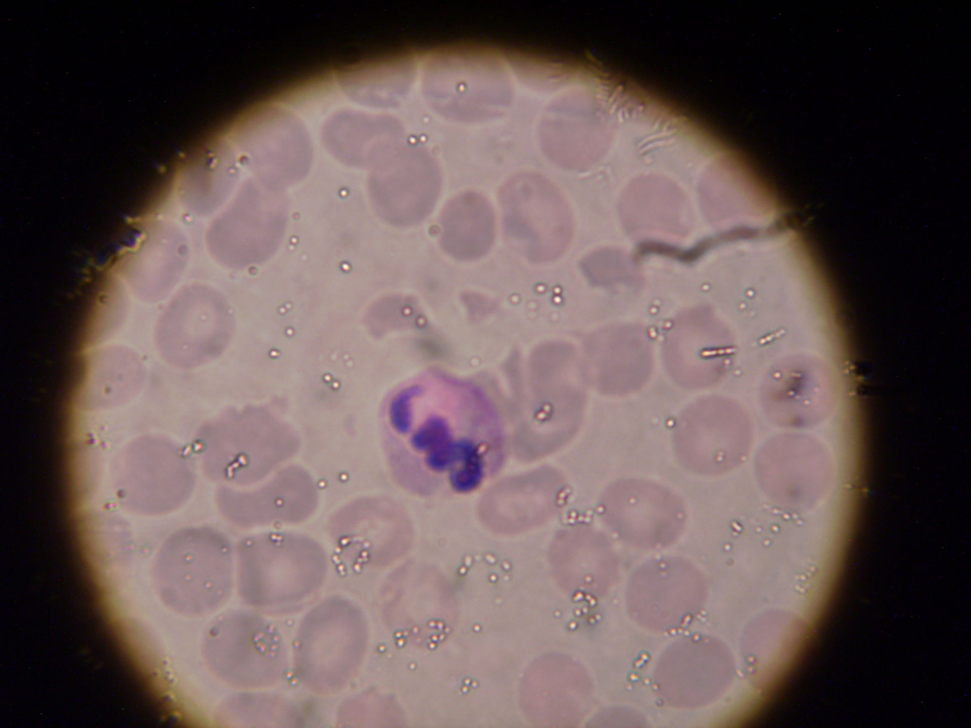 Plasmodium a forma di nastro