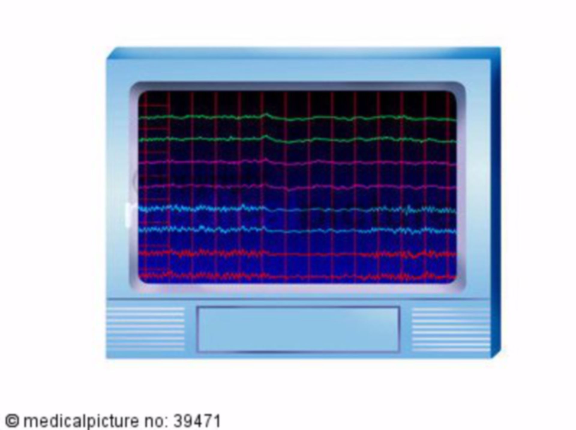  EEG - Messung, electroencephalogramm 
