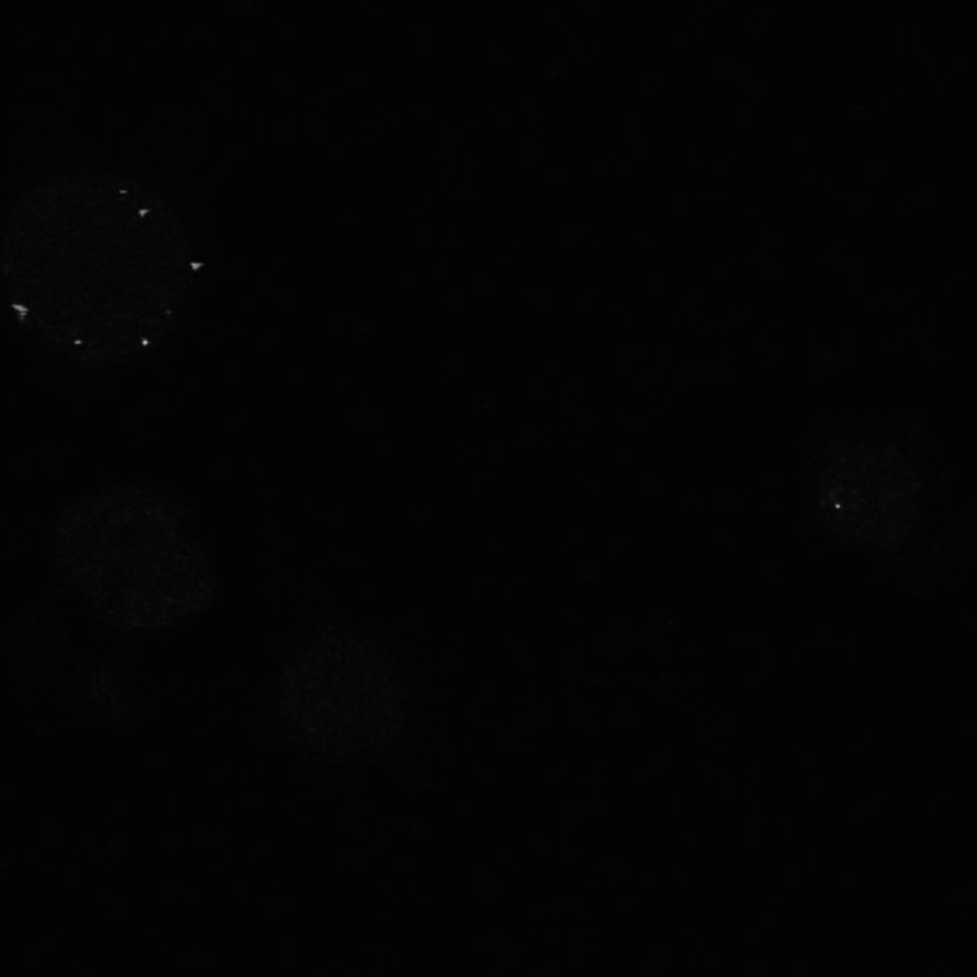 Xenopus laevis (Neuronal cell body) - CIL:37025