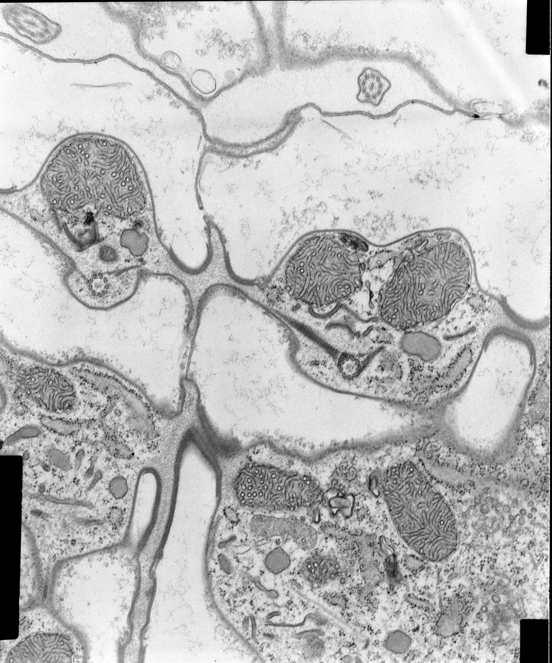 Coleps hirtus (Associated microtubules) - CIL:9015