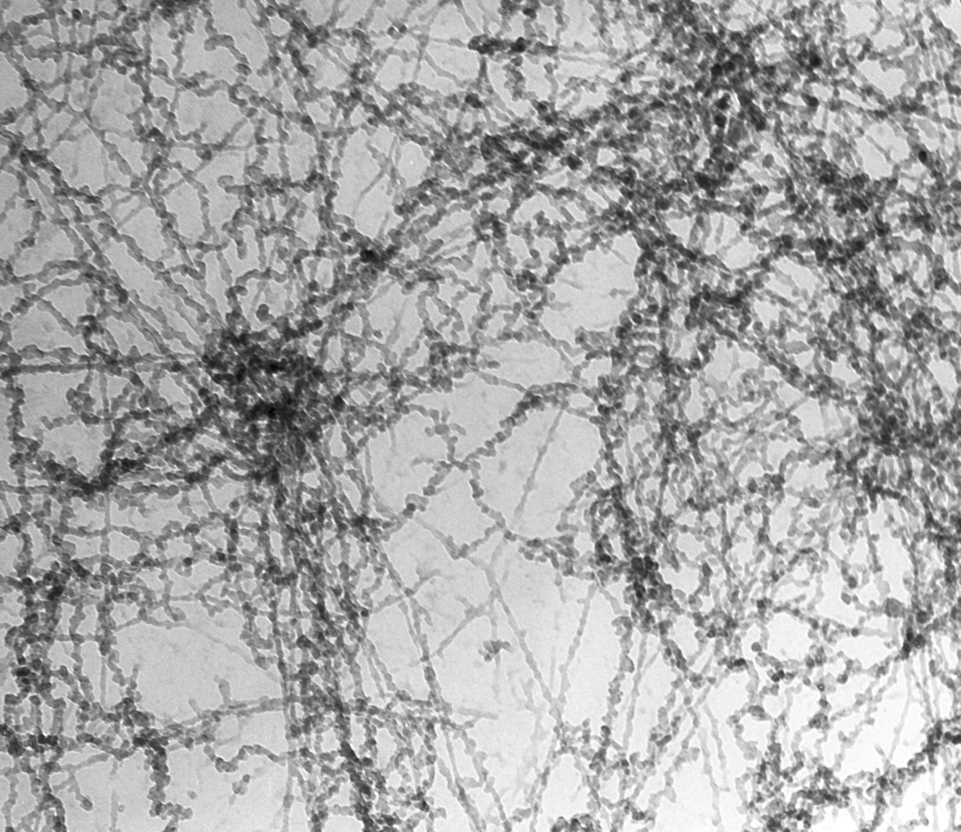 Notopthalmus viridescence (Nuclear chromatin) - CIL:10086